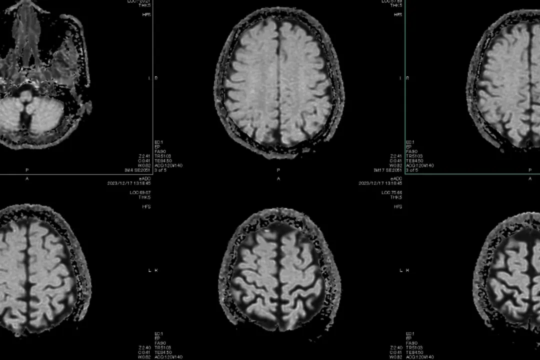 Healthcare Is AI s Hardest Test healthcare-is-ai-s-hardest-test
