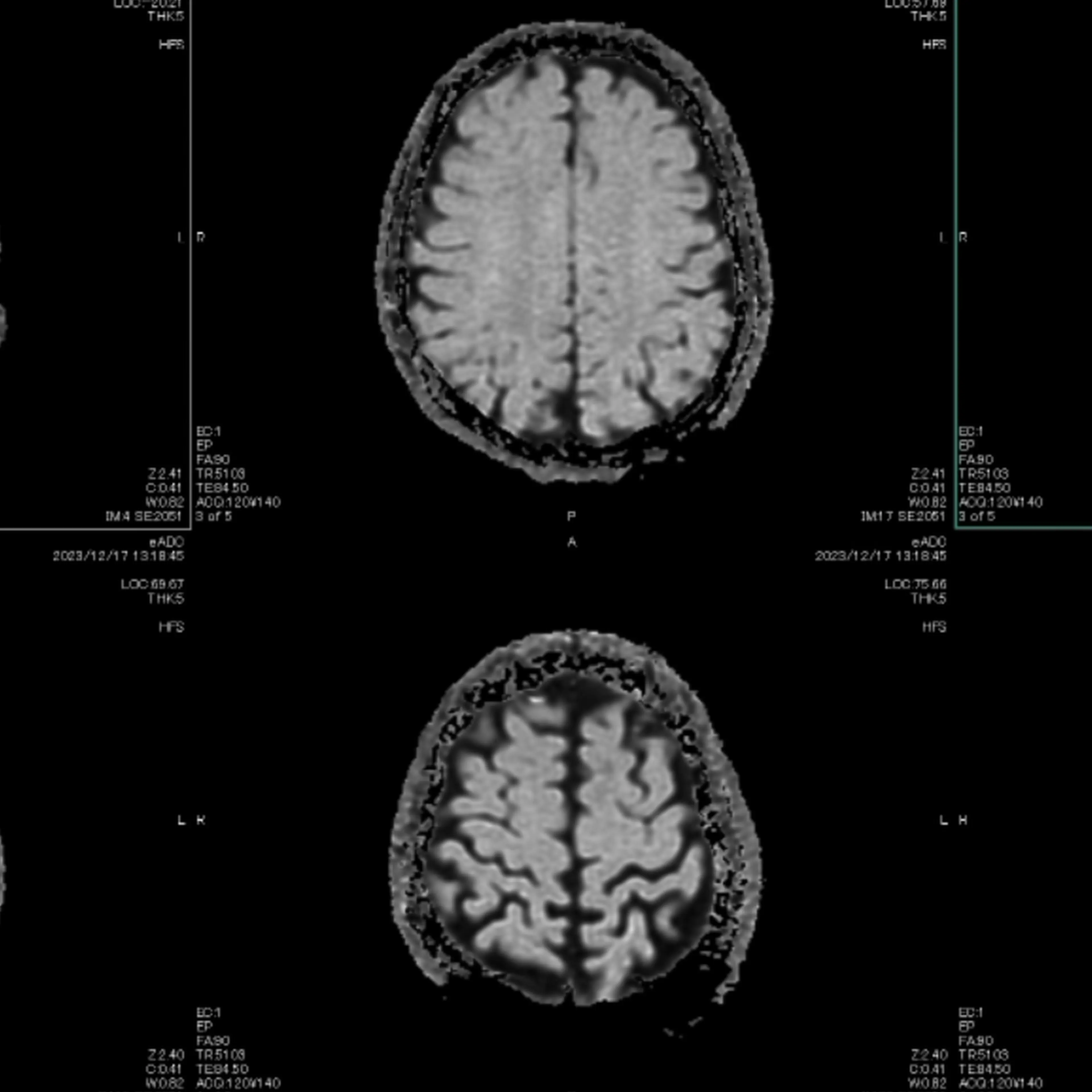 A magnetic MRI scan of a brain.