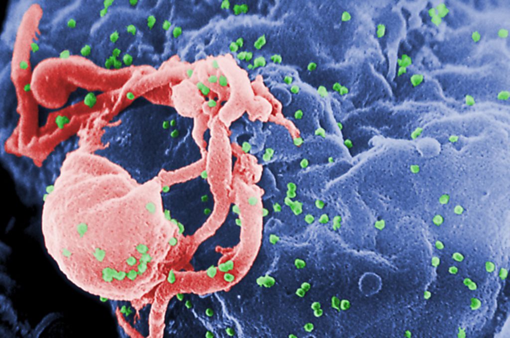 HIV-1 Virions