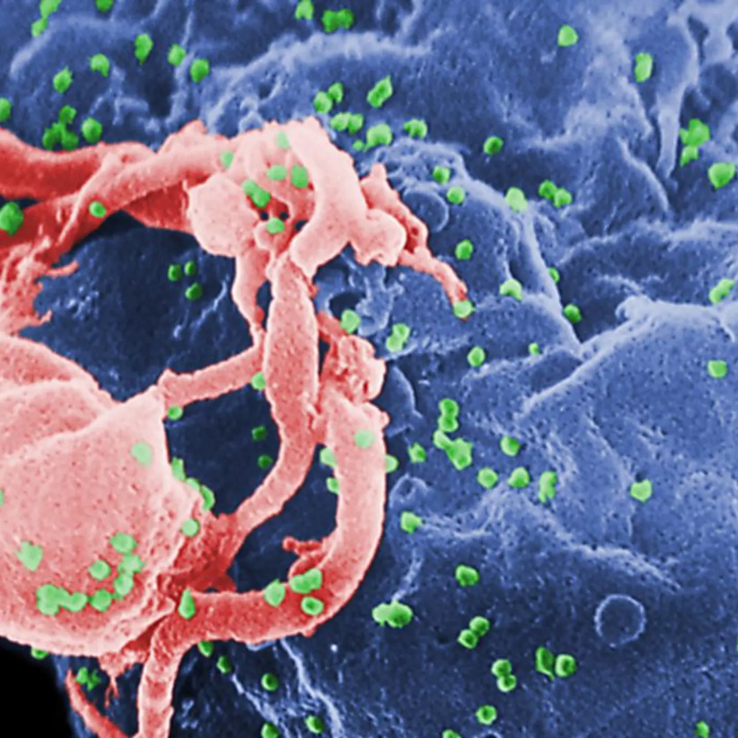 HIV-1 Virions