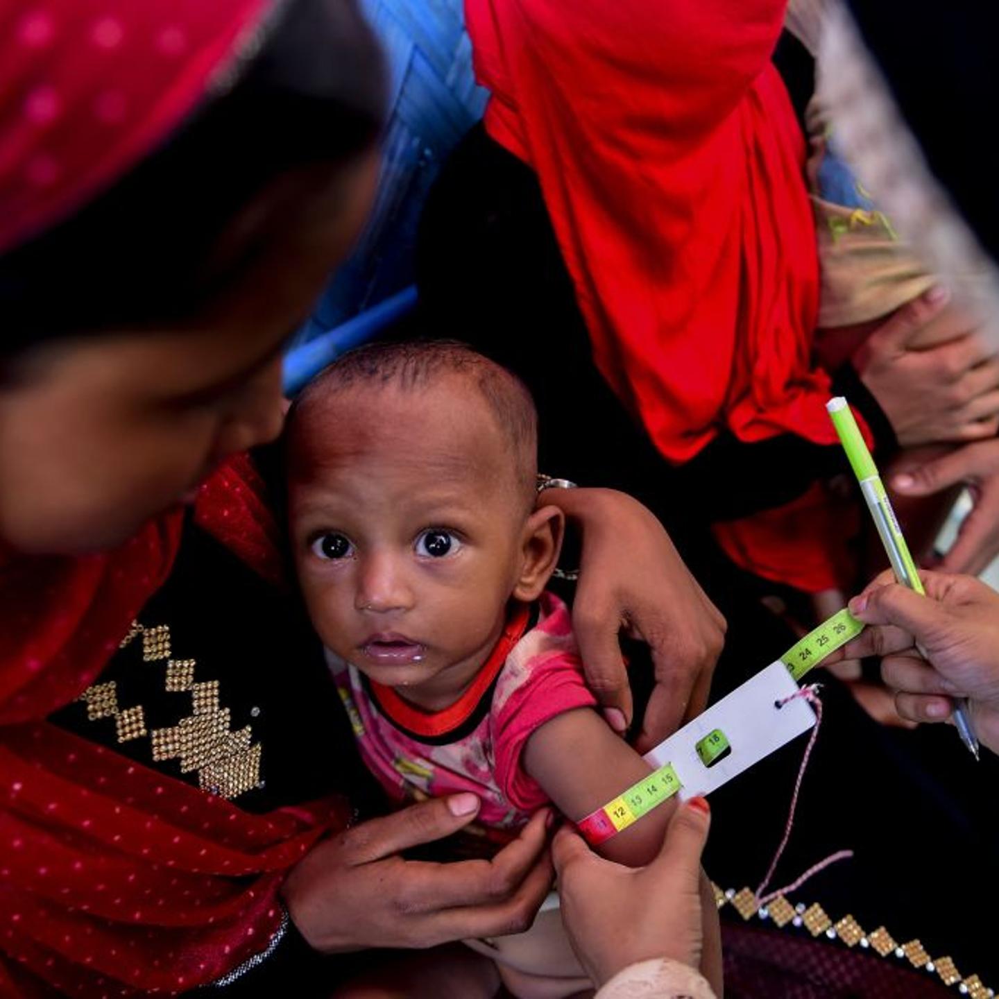 BANGLADESH-MYANMAR-UNREST-REFUGEE-ROHINGYA-MALNUTRITION-CHILDREN
