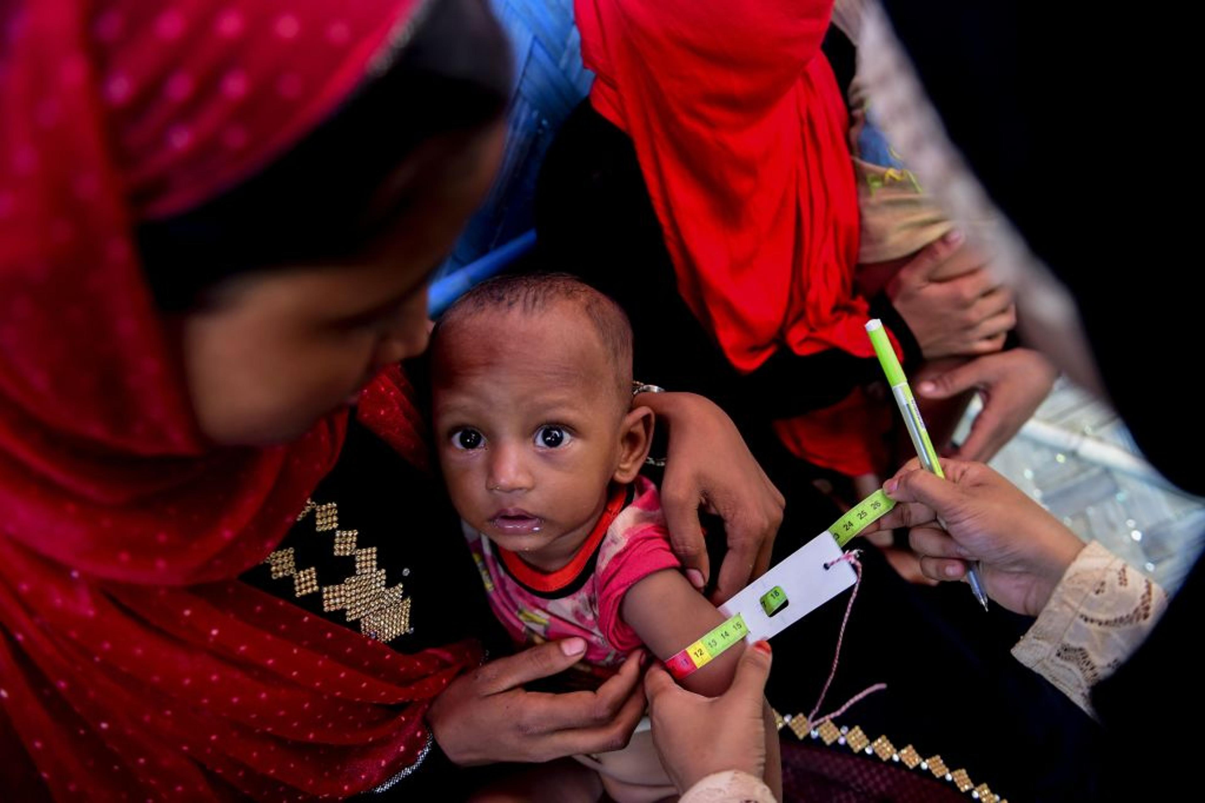BANGLADESH-MYANMAR-UNREST-REFUGEE-ROHINGYA-MALNUTRITION-CHILDREN