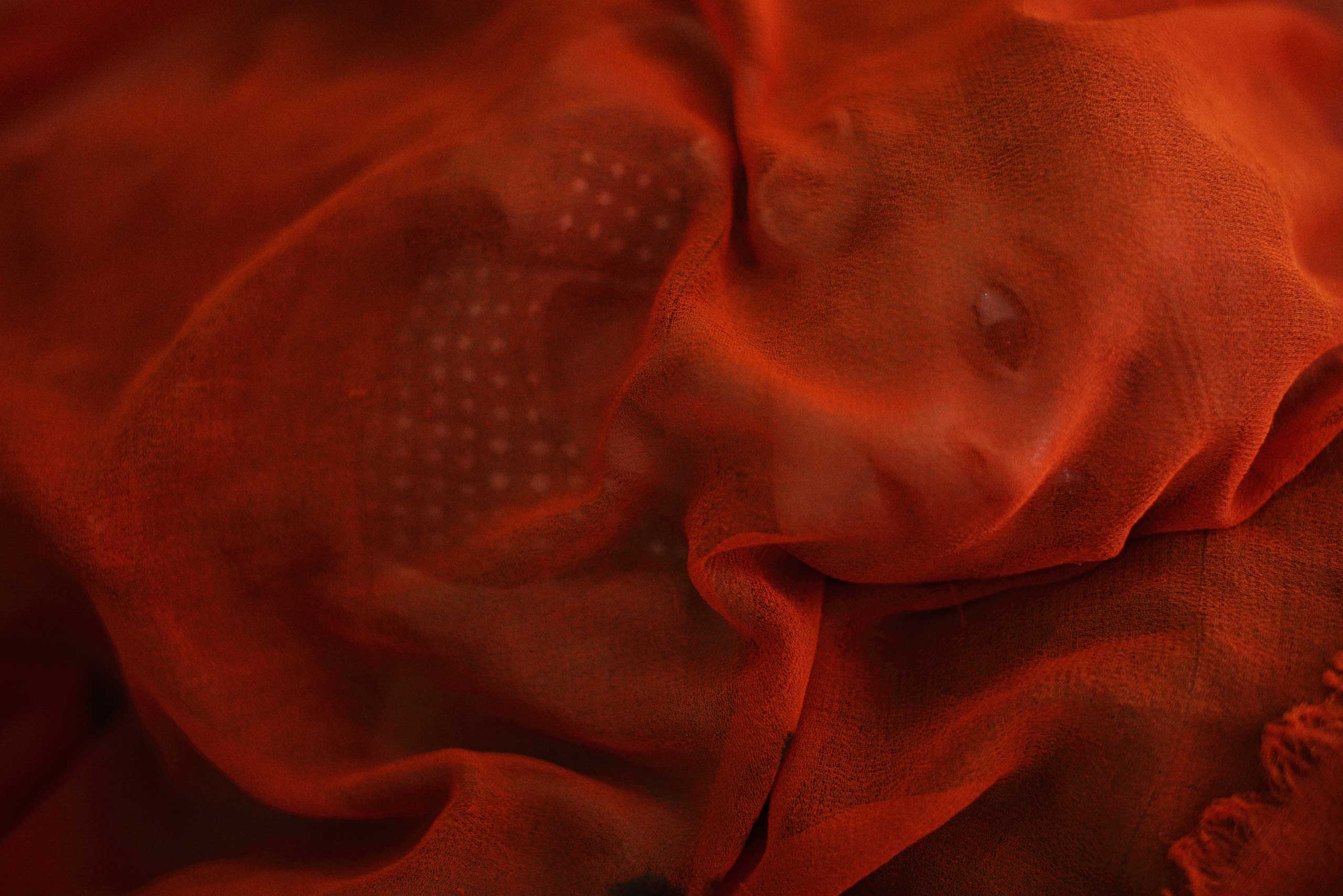 Gul Ahmad, an infant boy suffering from acute malnutrition, is covered by his mother's scarf while being treated in the therapeutic feeding centre ward at the Medecins Sans Frontieres (MSF) administered Boost Hospital in Lashkar Gah, the capial of Helamn