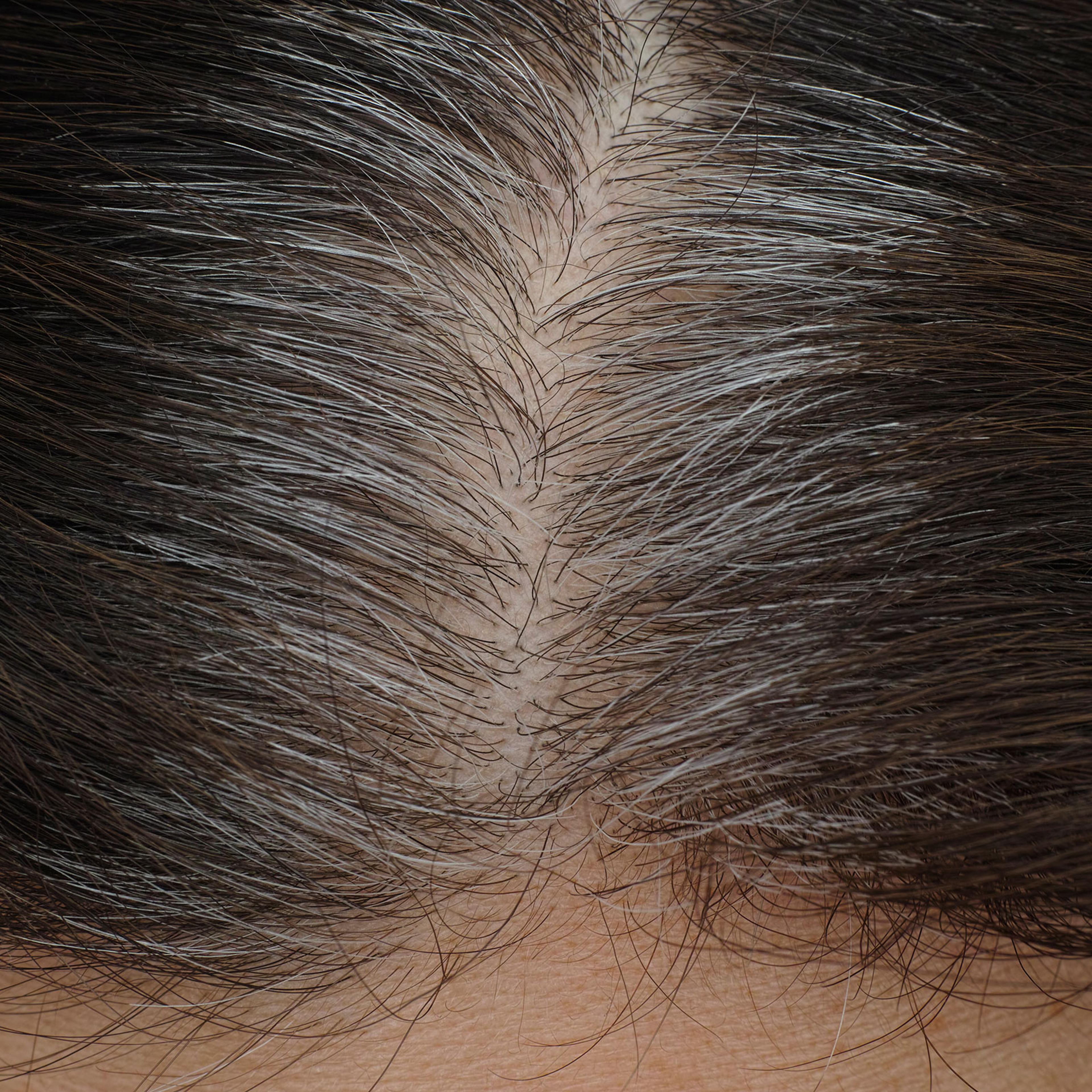 Gray roots seen on a brunette woman