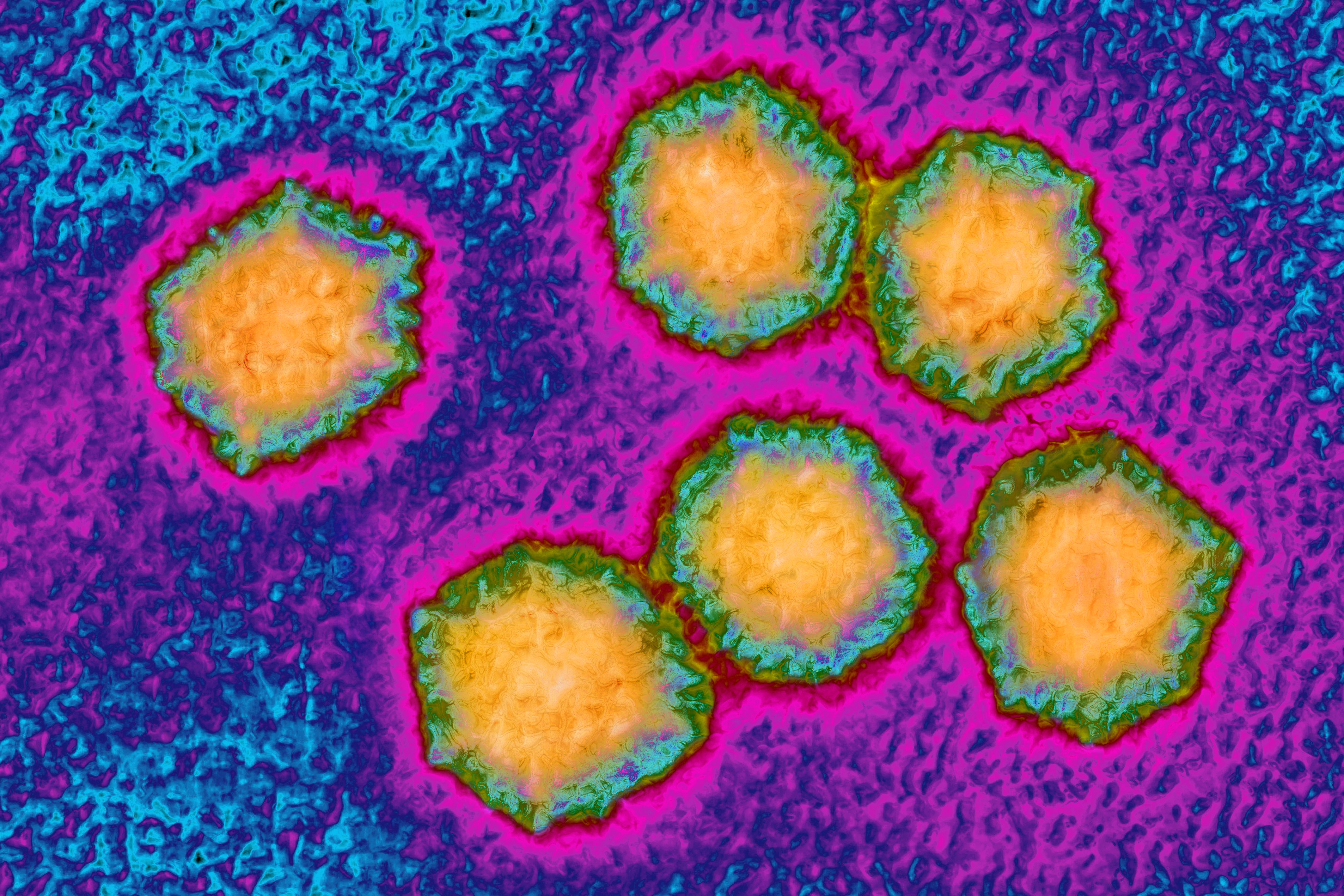 Hepatitis A virus (HAV). Image produced from an image taken with transmission electron microscopy.