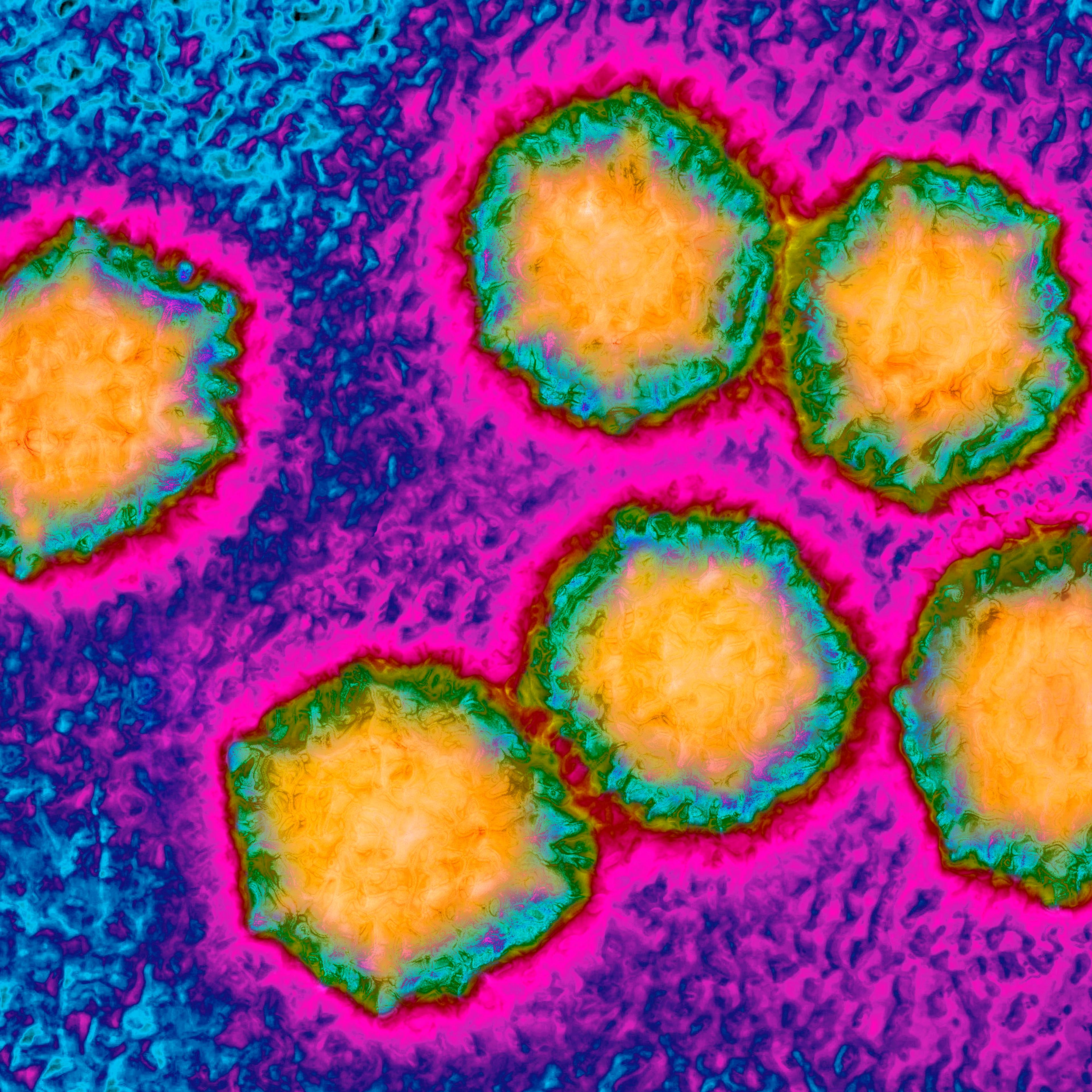 Hepatitis A virus (HAV). Image produced from an image taken with transmission electron microscopy.