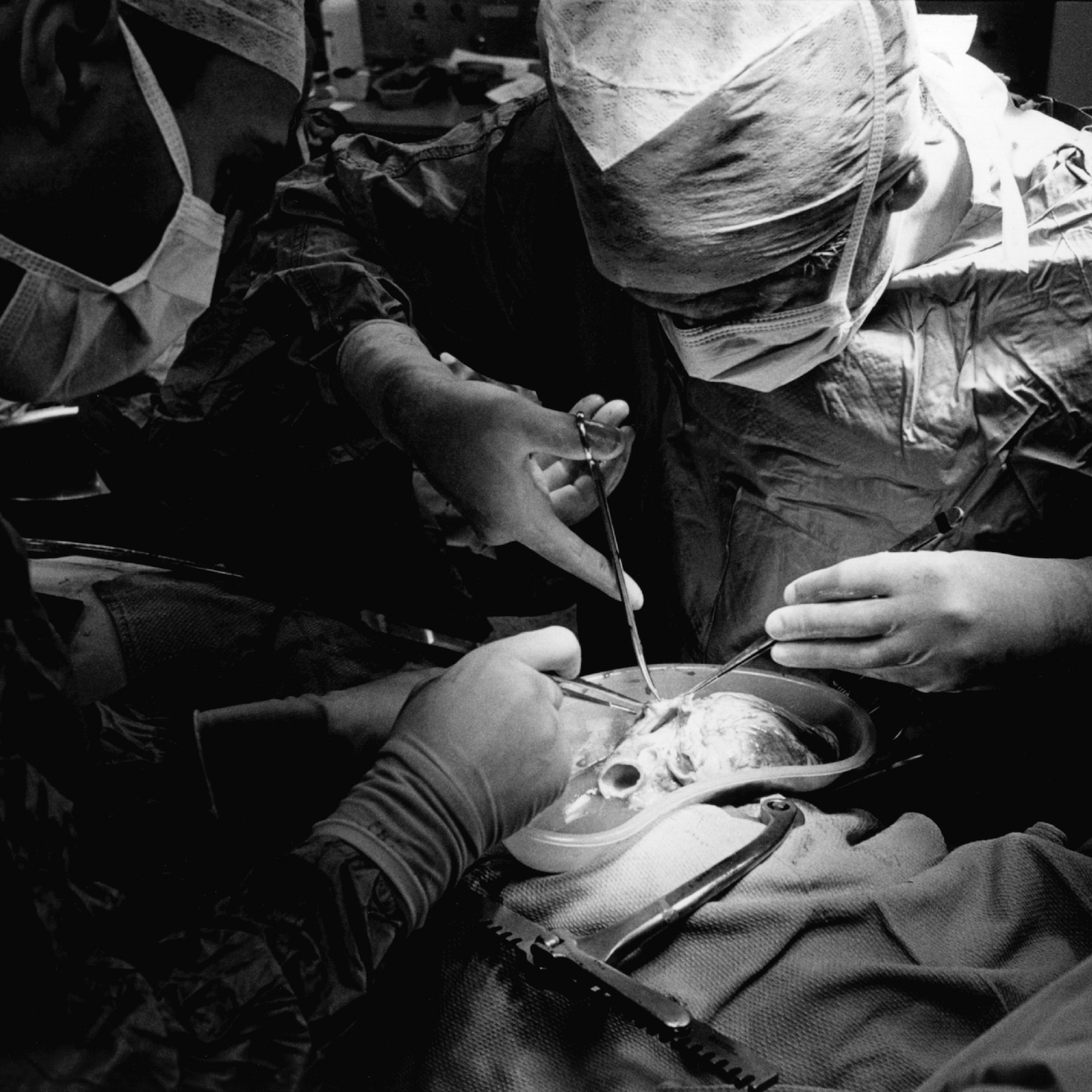 Heart Transplant Operation