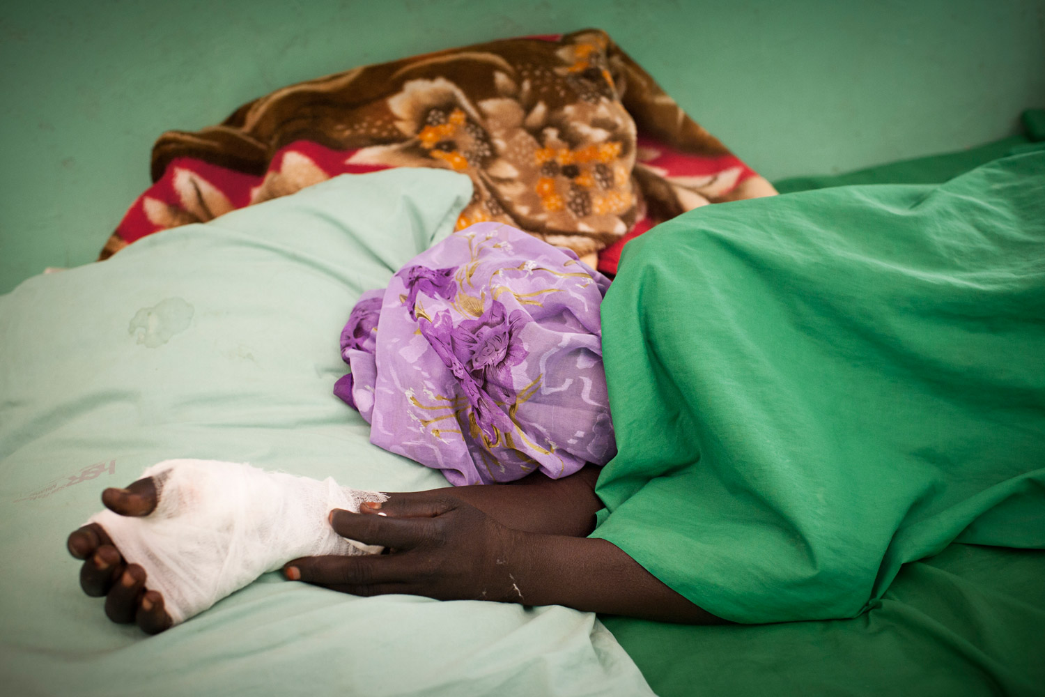 A civilian wounded after her village was bombed by northern Sudanese aircraft rests inside a hospital in the Nuba Mountains, July 2, 2011.