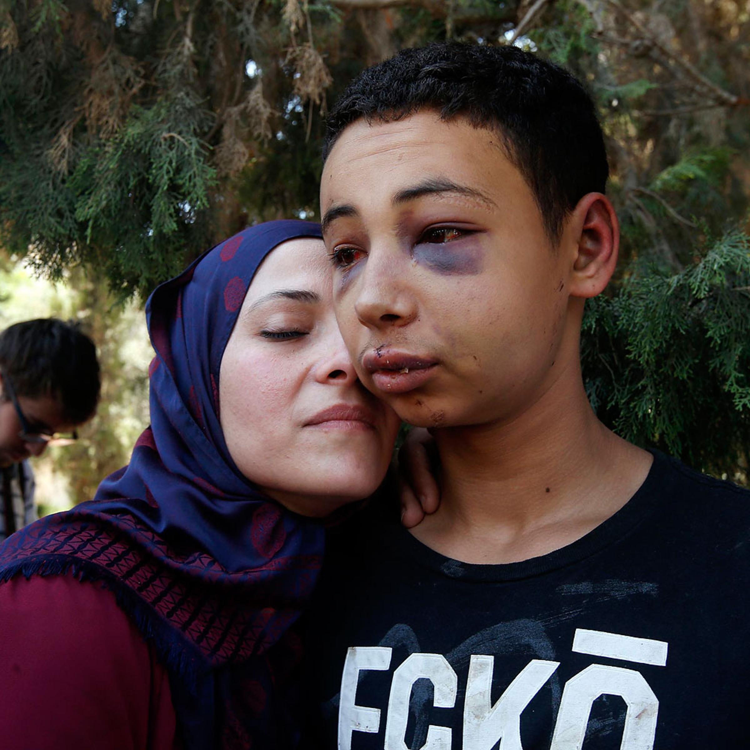 Tariq Khdeir is greeted by his mother after being released from jail in Jerusalem