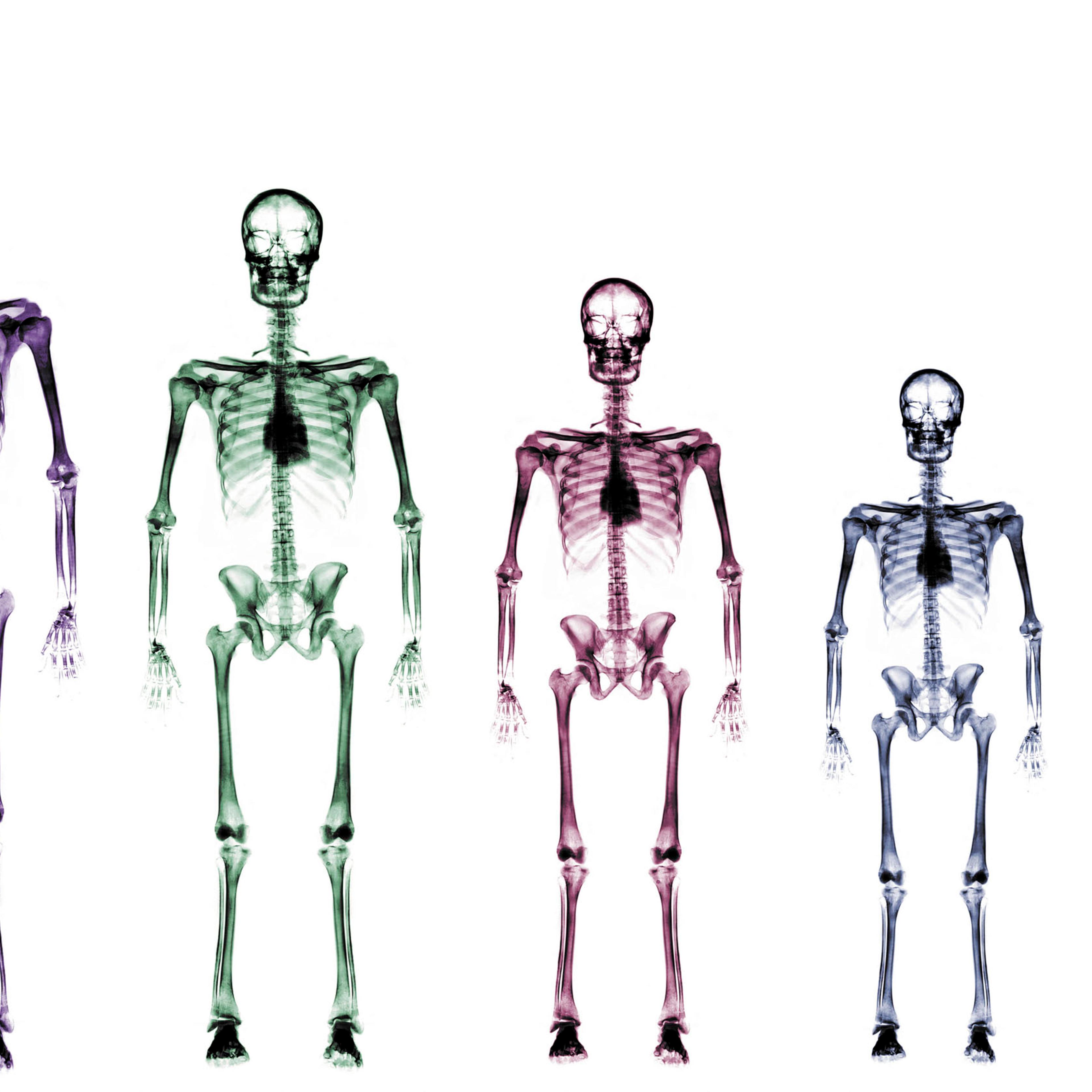 Skeleton growth chart