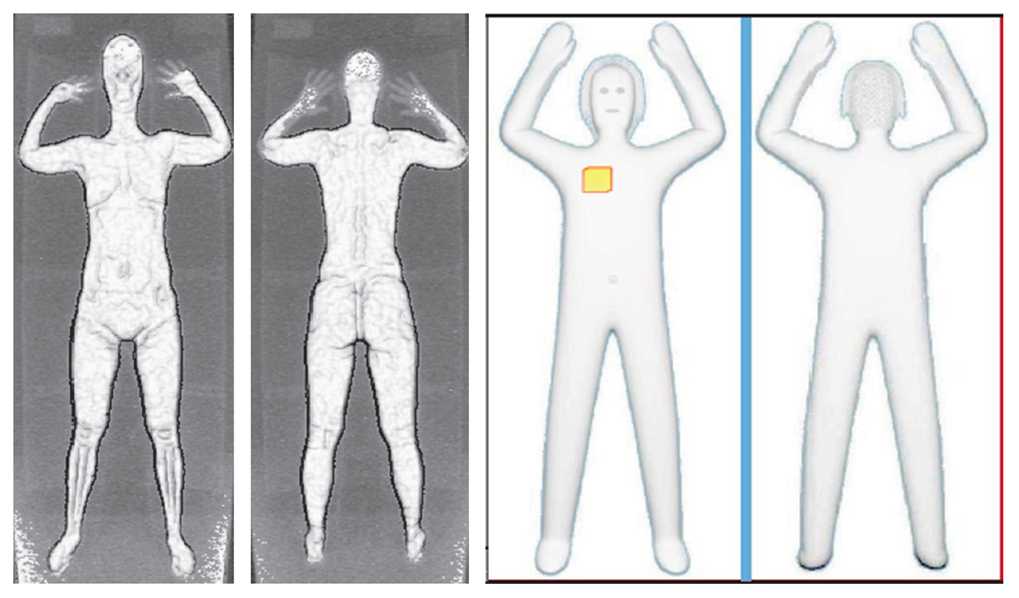 Sample images that show details of what TSA officers see on computer monitors when passengers pass through airport body scanners.