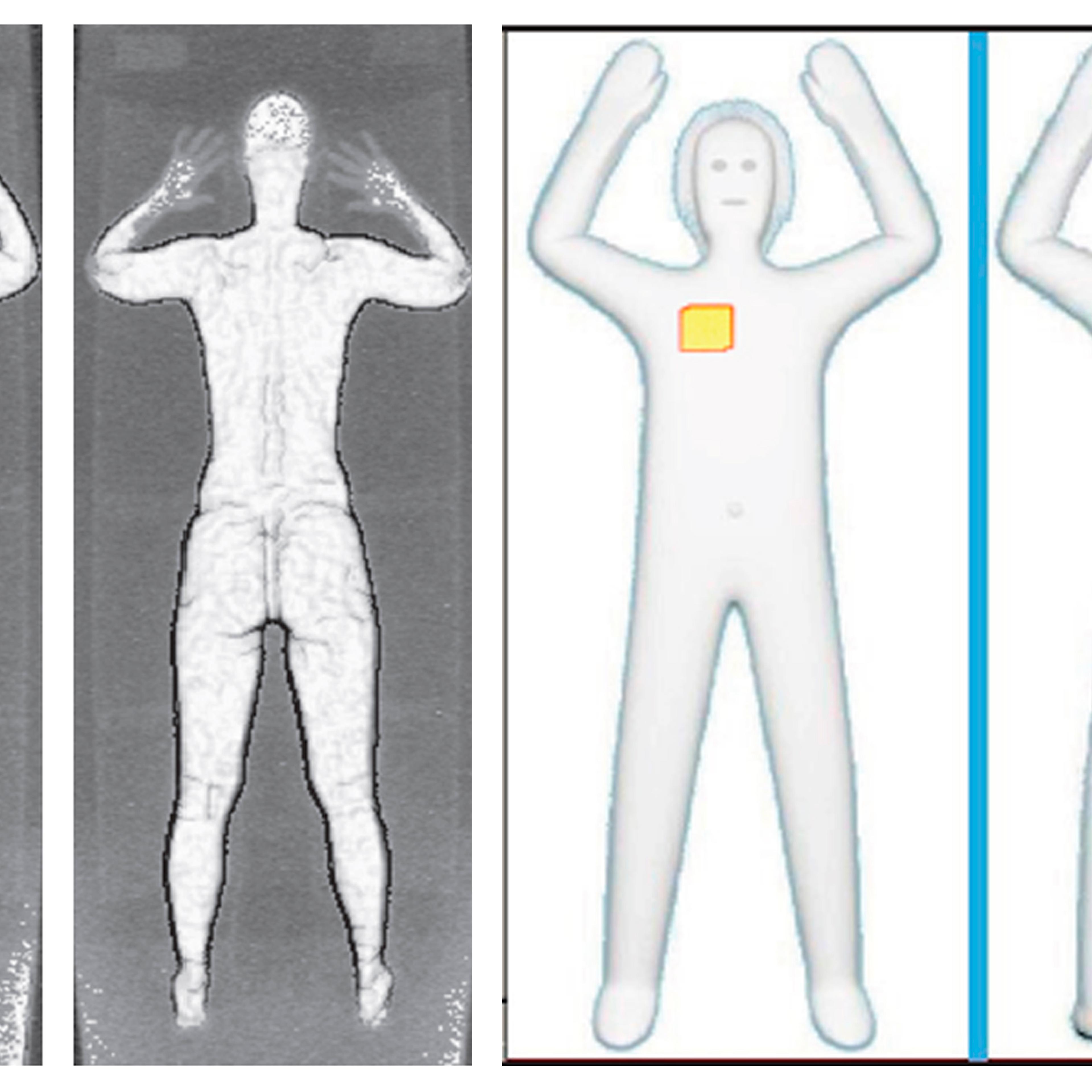 Sample images that show details of what TSA officers see on computer monitors when passengers pass through airport body scanners.