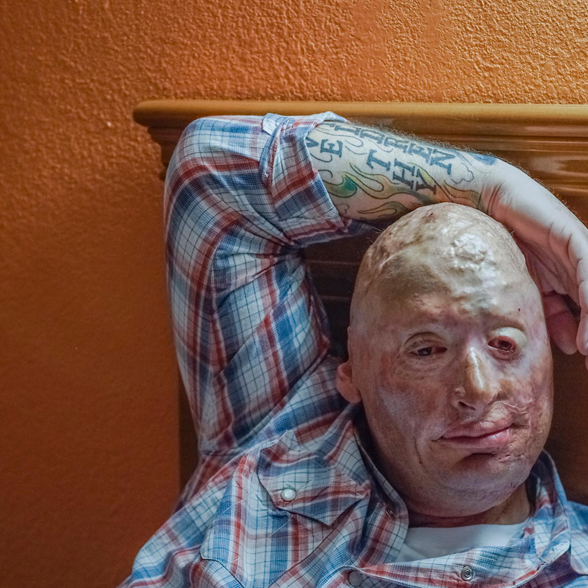 2012. Dallas, TX. USA. Bobby in a Motel 6 in Dallas. Bobby Henline, 41, veteran of four tours to Iraq and sole survivor of an IED blast that killed the other four soldiers in his humvee in Iraq in 2007. He is now a standup comedian launching a new c