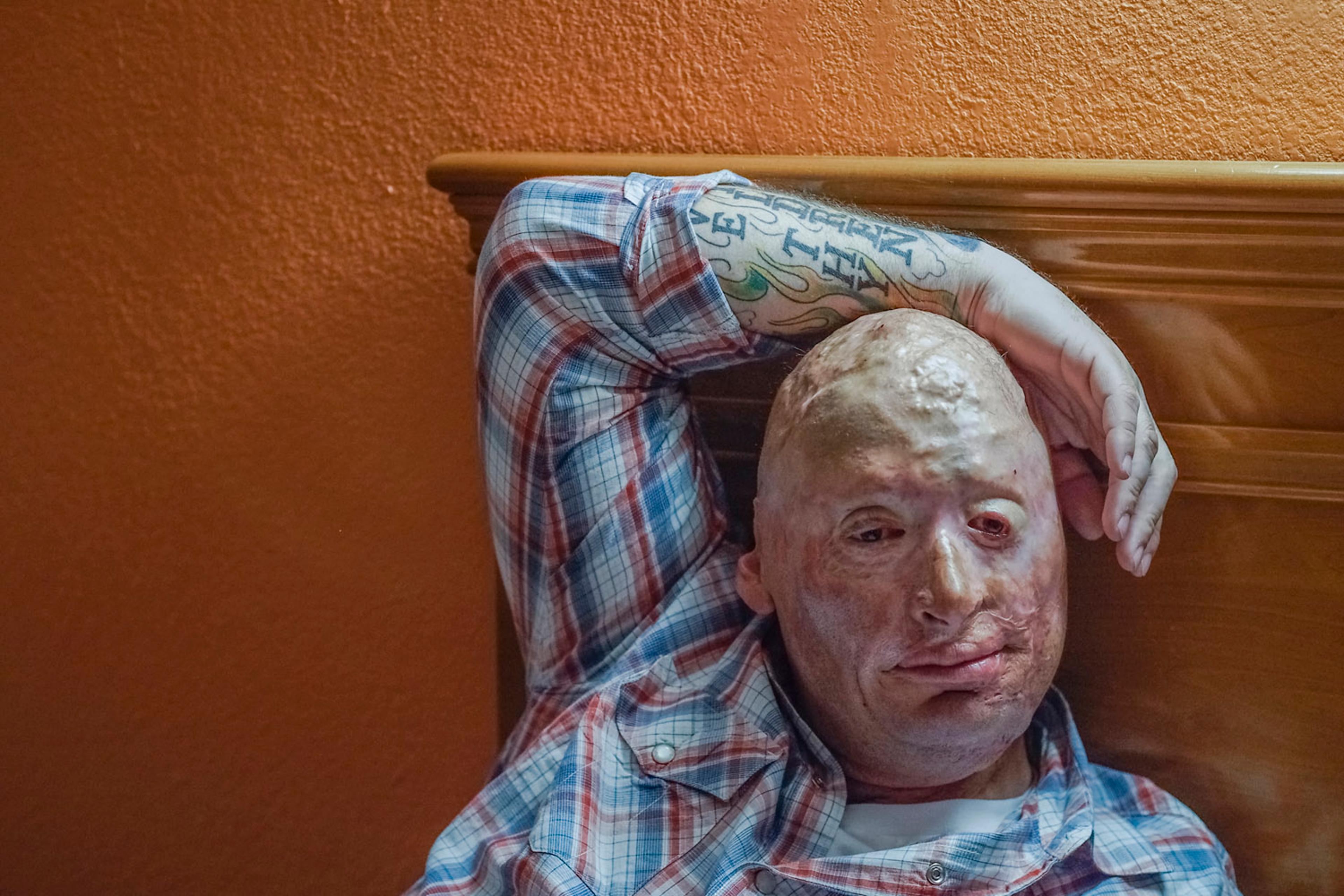 2012. Dallas, TX. USA. Bobby in a Motel 6 in Dallas. Bobby Henline, 41, veteran of four tours to Iraq and sole survivor of an IED blast that killed the other four soldiers in his humvee in Iraq in 2007. He is now a standup comedian launching a new c