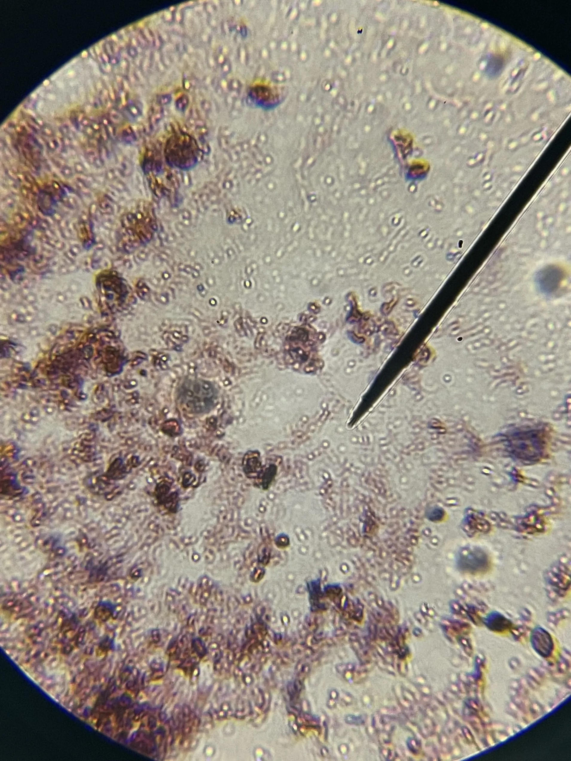 Windfall Bio Methane-Eating Microbes
