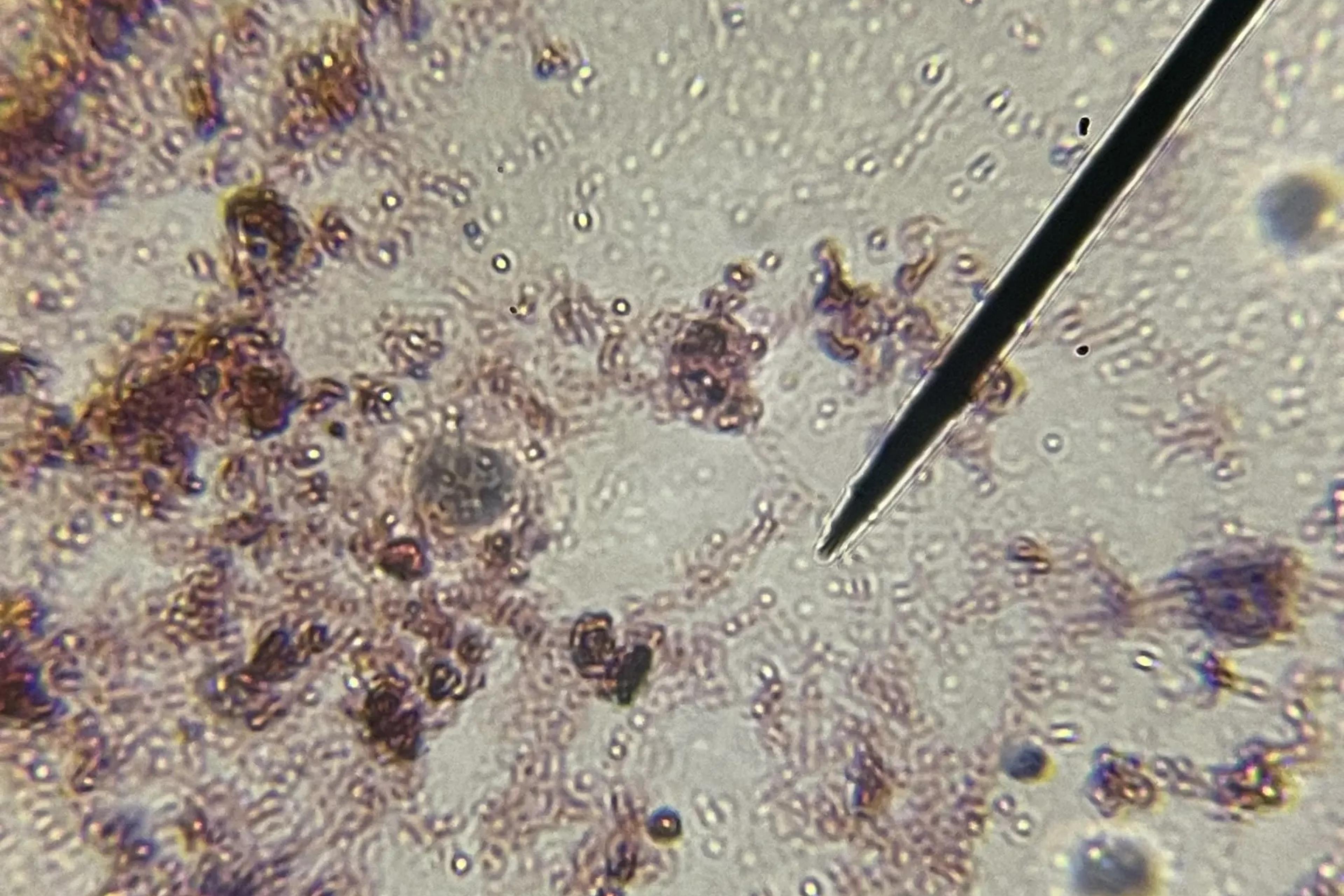 Windfall Bio Methane-Eating Microbes