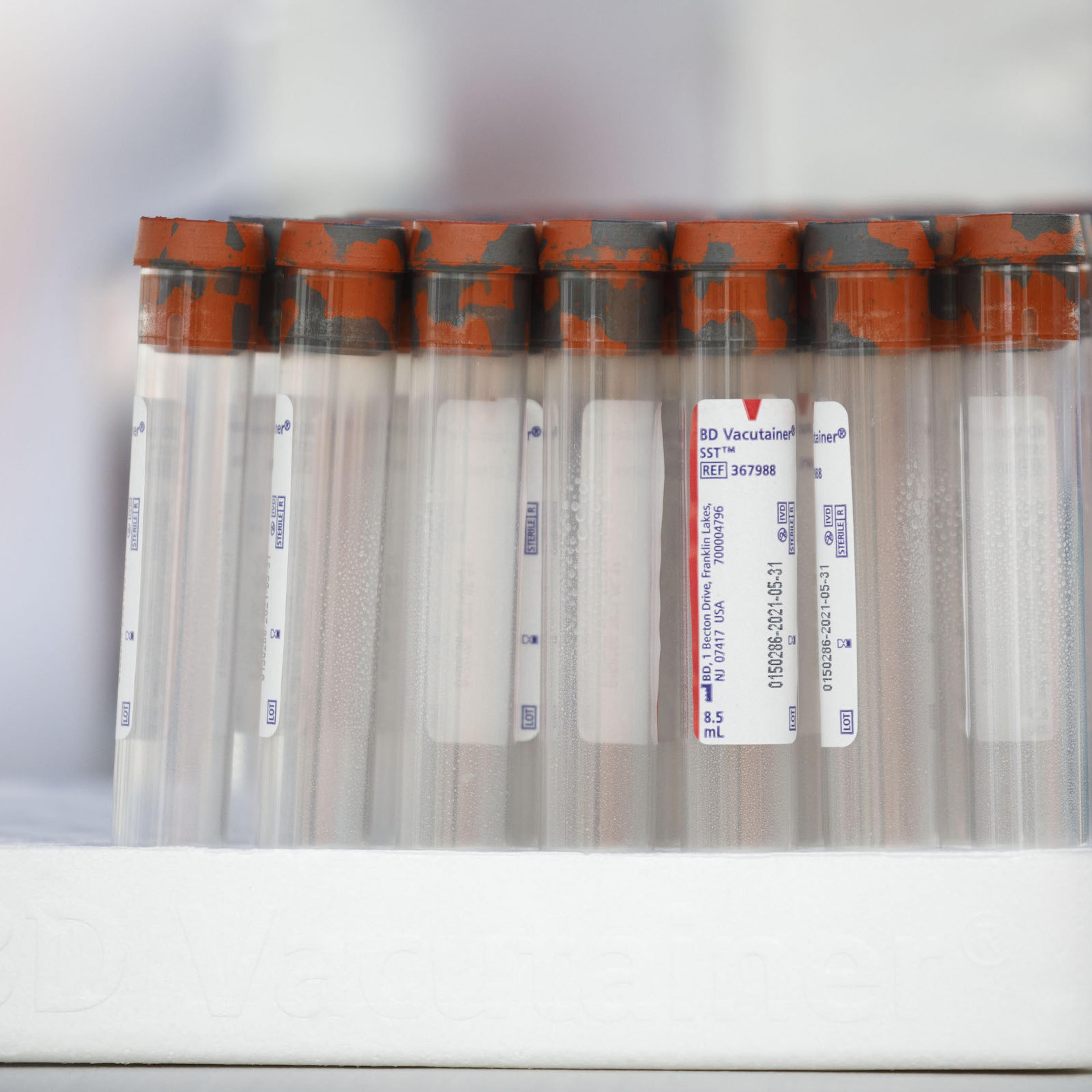 REmpty Becton, Dickinson & Co. (BD) vacutainer tubes for blood samples stand at a GUARDaHEART Foundation testing site in Los Angeles, California, U.S., on Aug. 5, 2020.