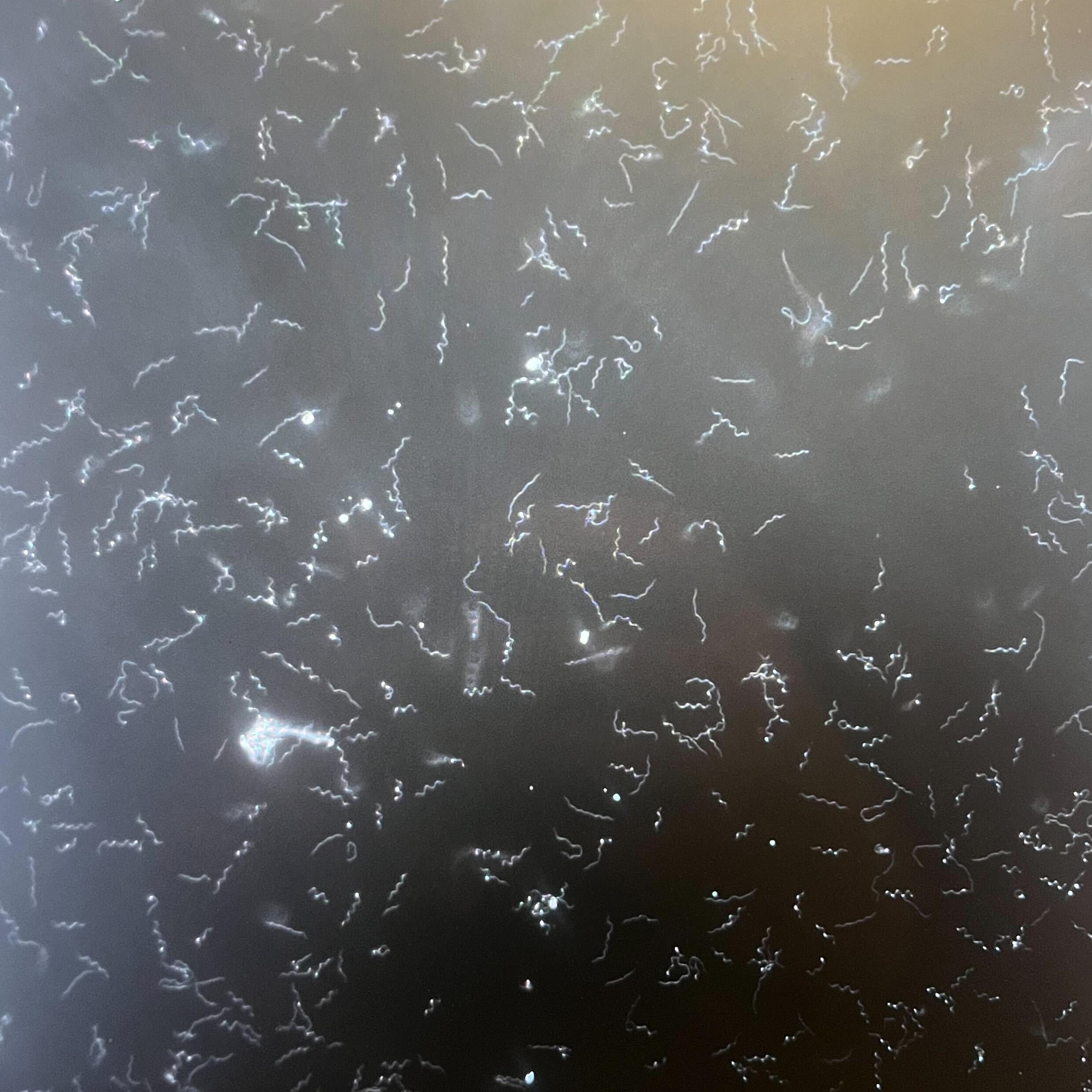 Borrelia burgdorferi