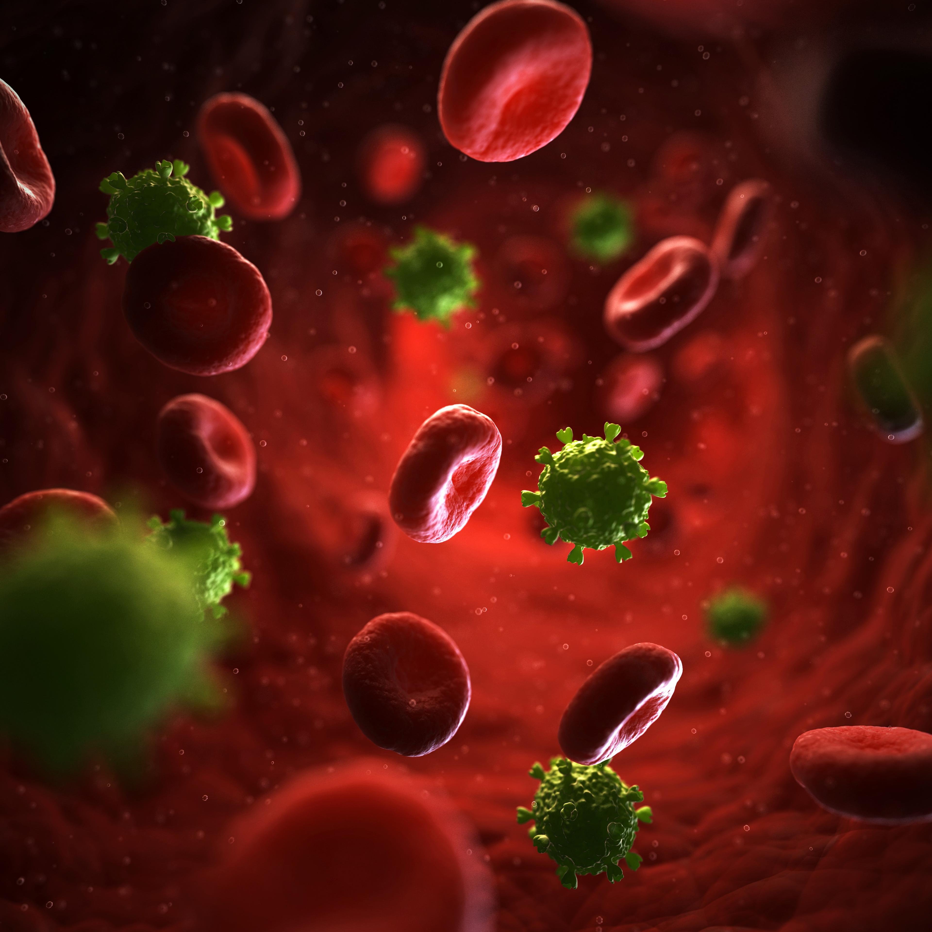 HIV AIDS