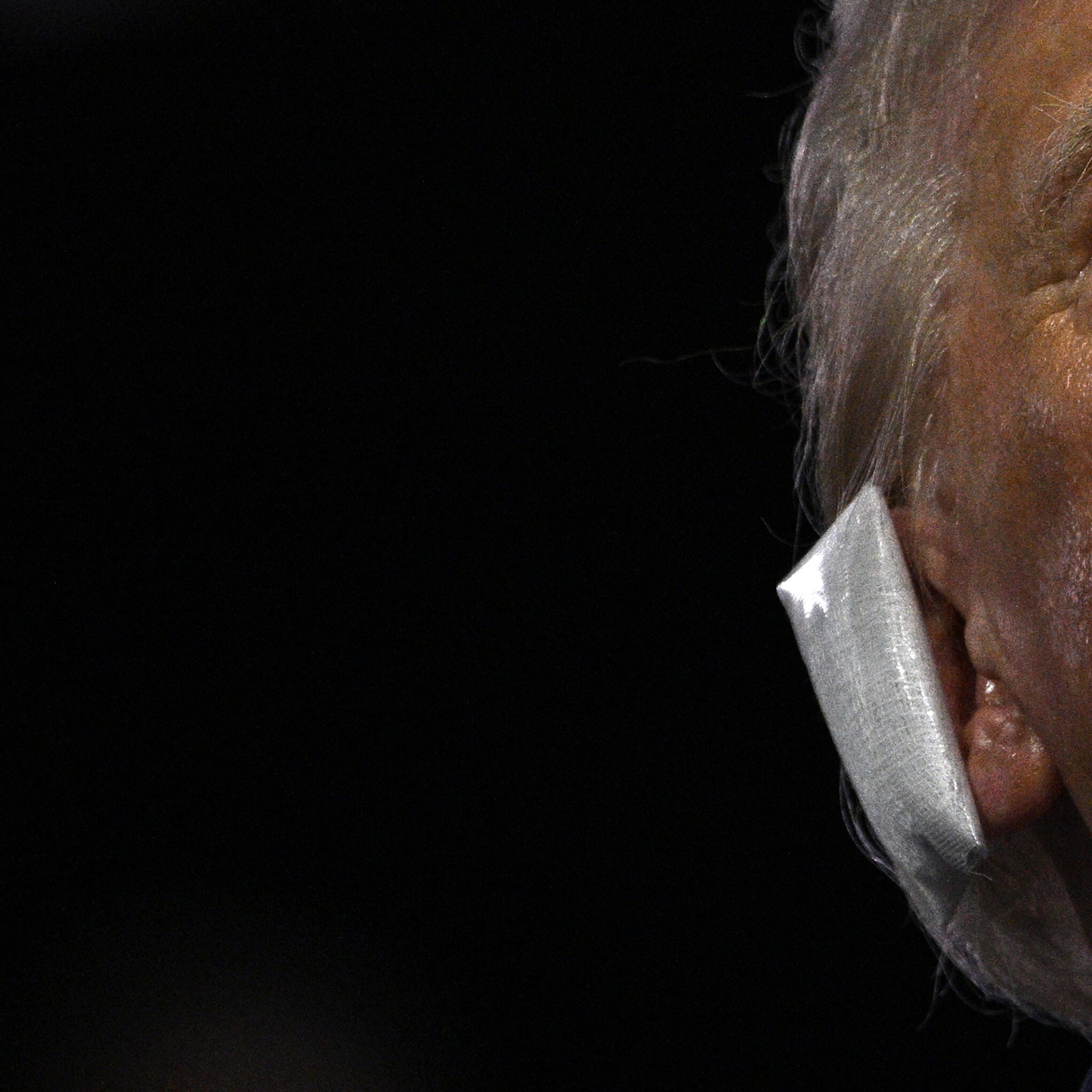 A bandage is seen on the ear of US former President Donald Trump after he was wounded in an assassination attempt during the first day of the 2024 Republican National Convention at the Fiserv Forum in Milwaukee, Wis., July 15, 2024.
