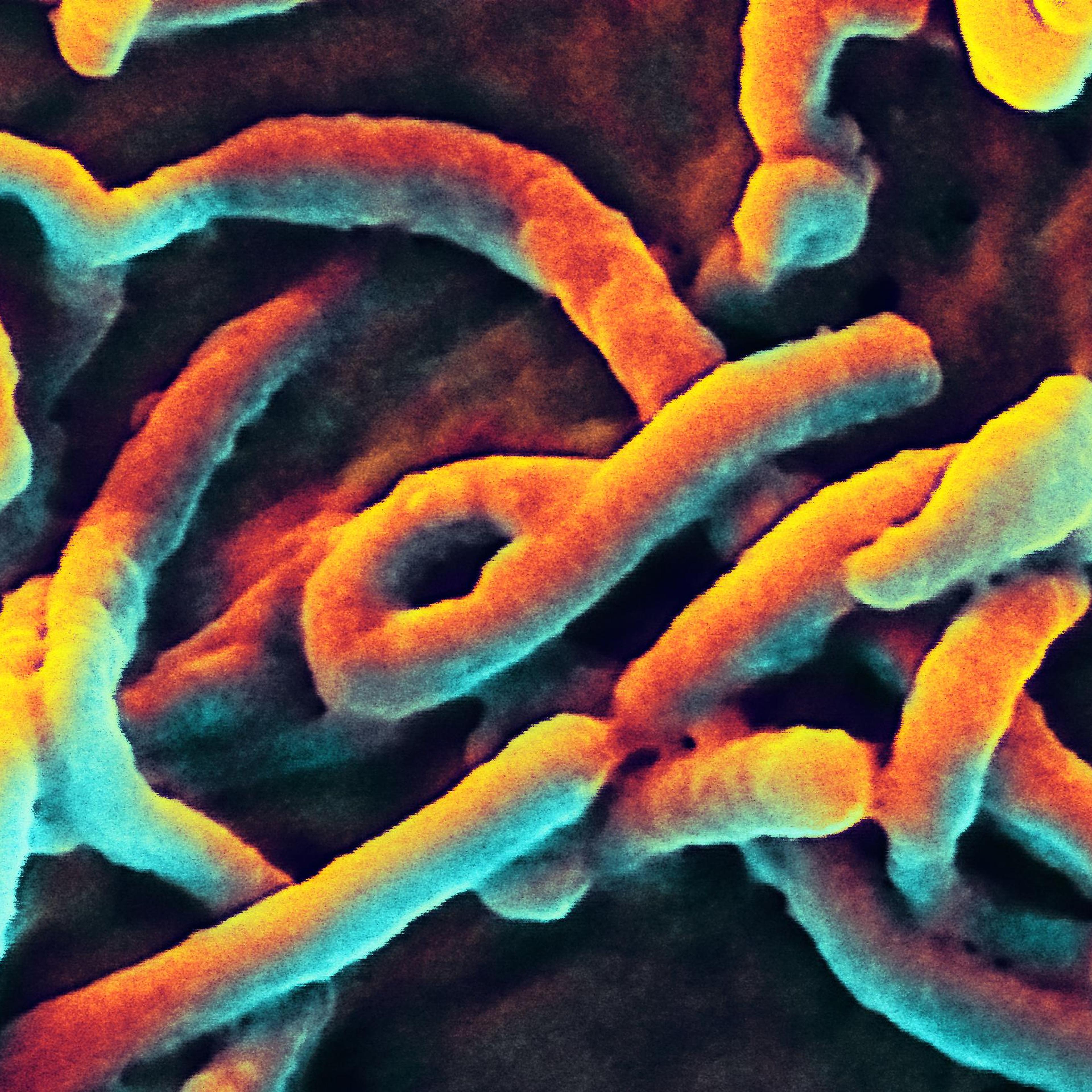 A scanning electron micrograph of Ebola virus budding from the surface of a Vero cell of an African green monkey kidney epithelial cell line.