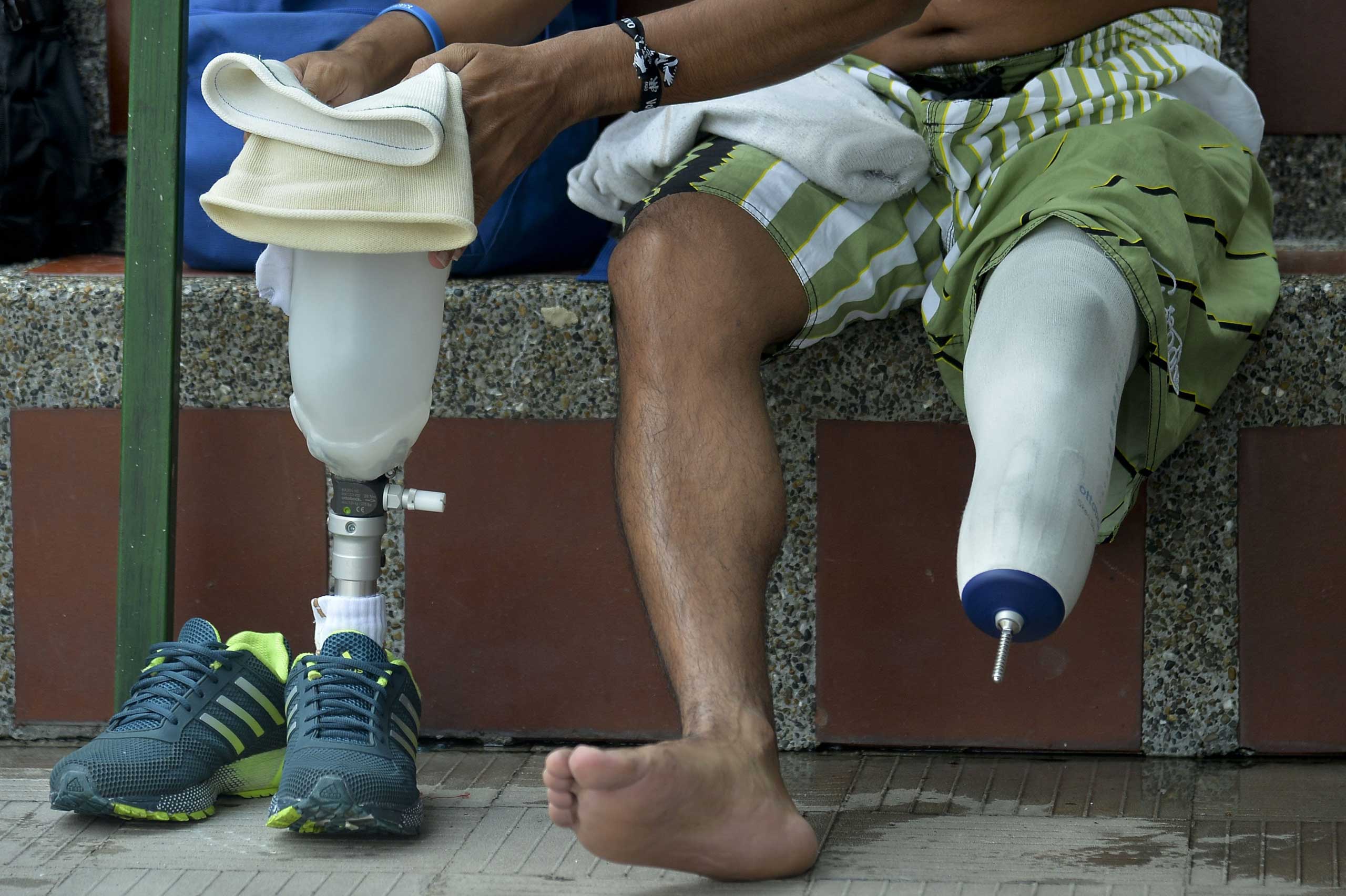 COLOMBIA-LANDMINES-VICTIMS-REHABILITATION