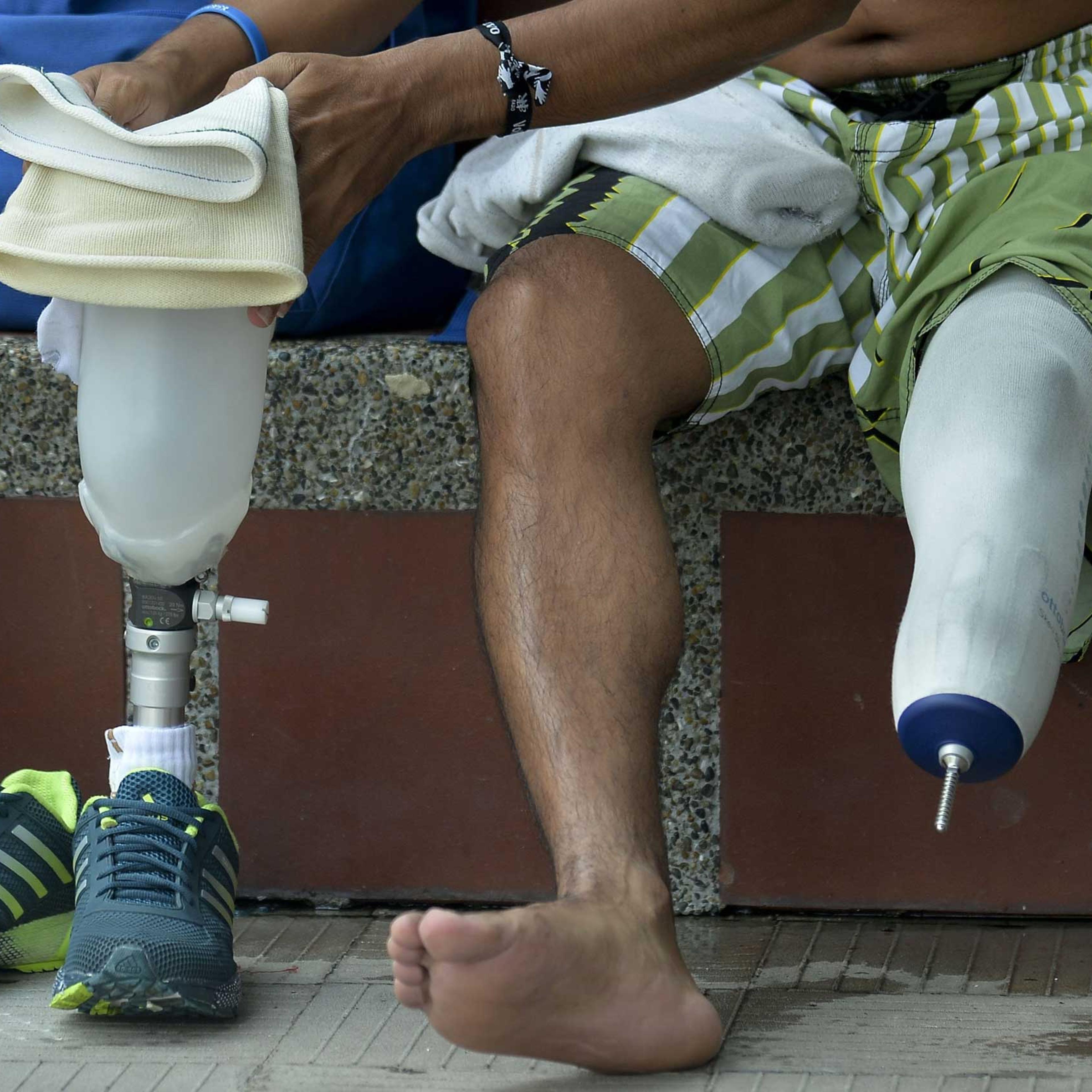 COLOMBIA-LANDMINES-VICTIMS-REHABILITATION
