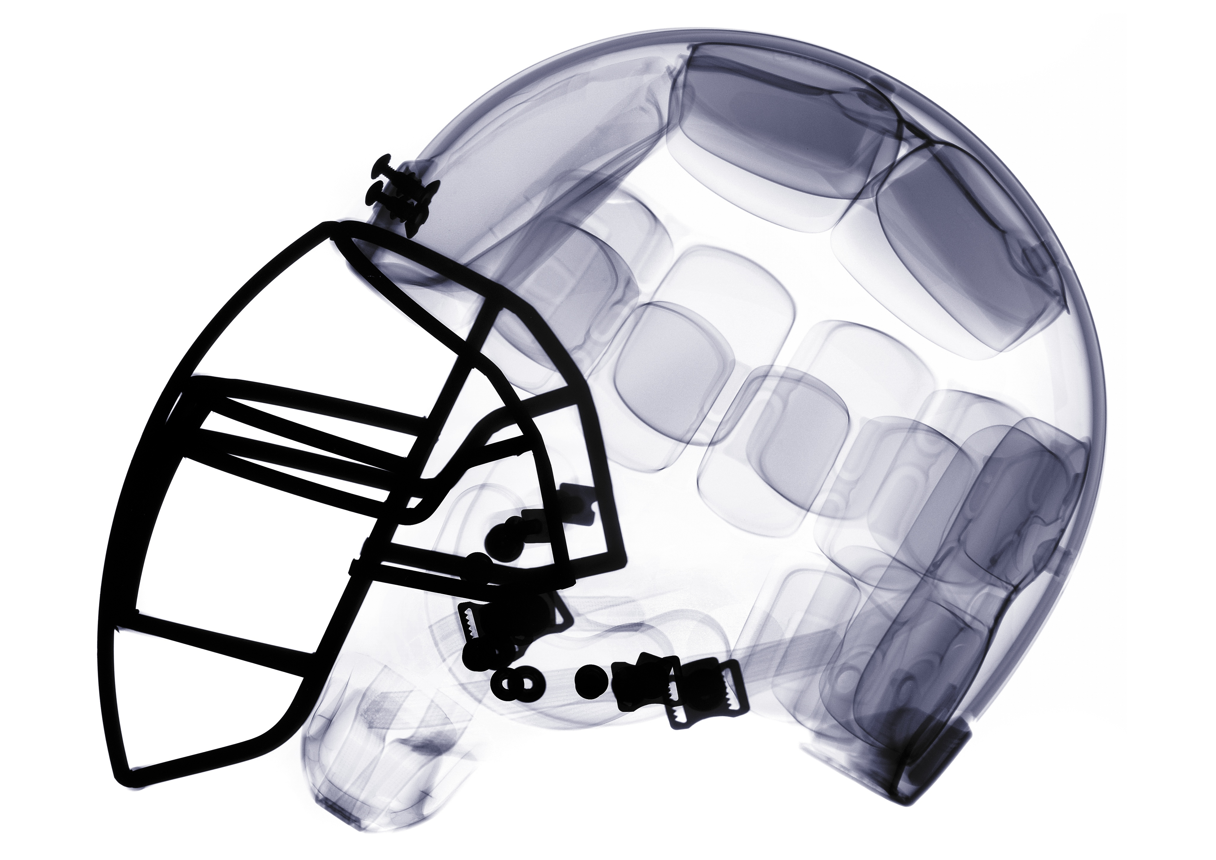 X-ray of american football helmet.