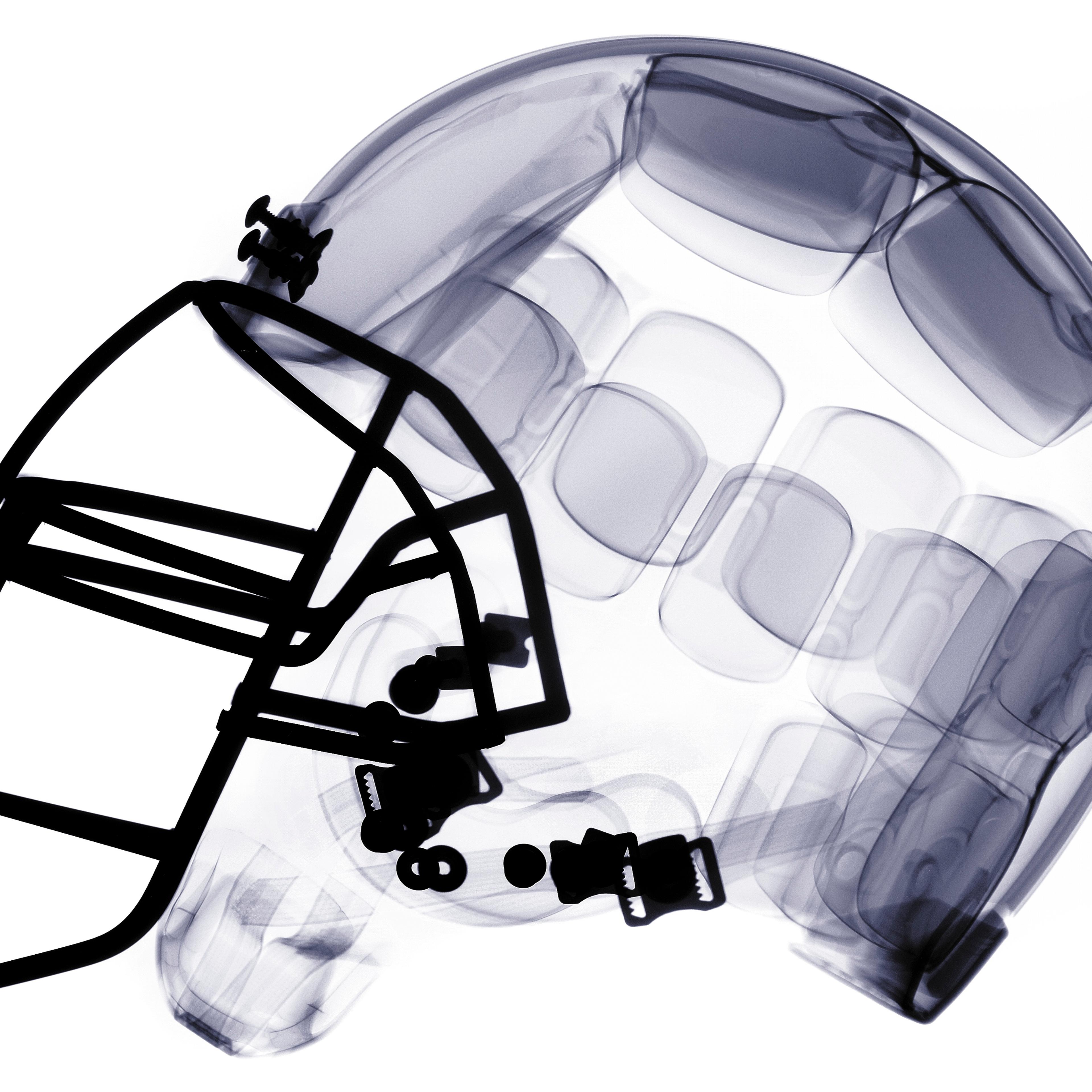 X-ray of american football helmet.
