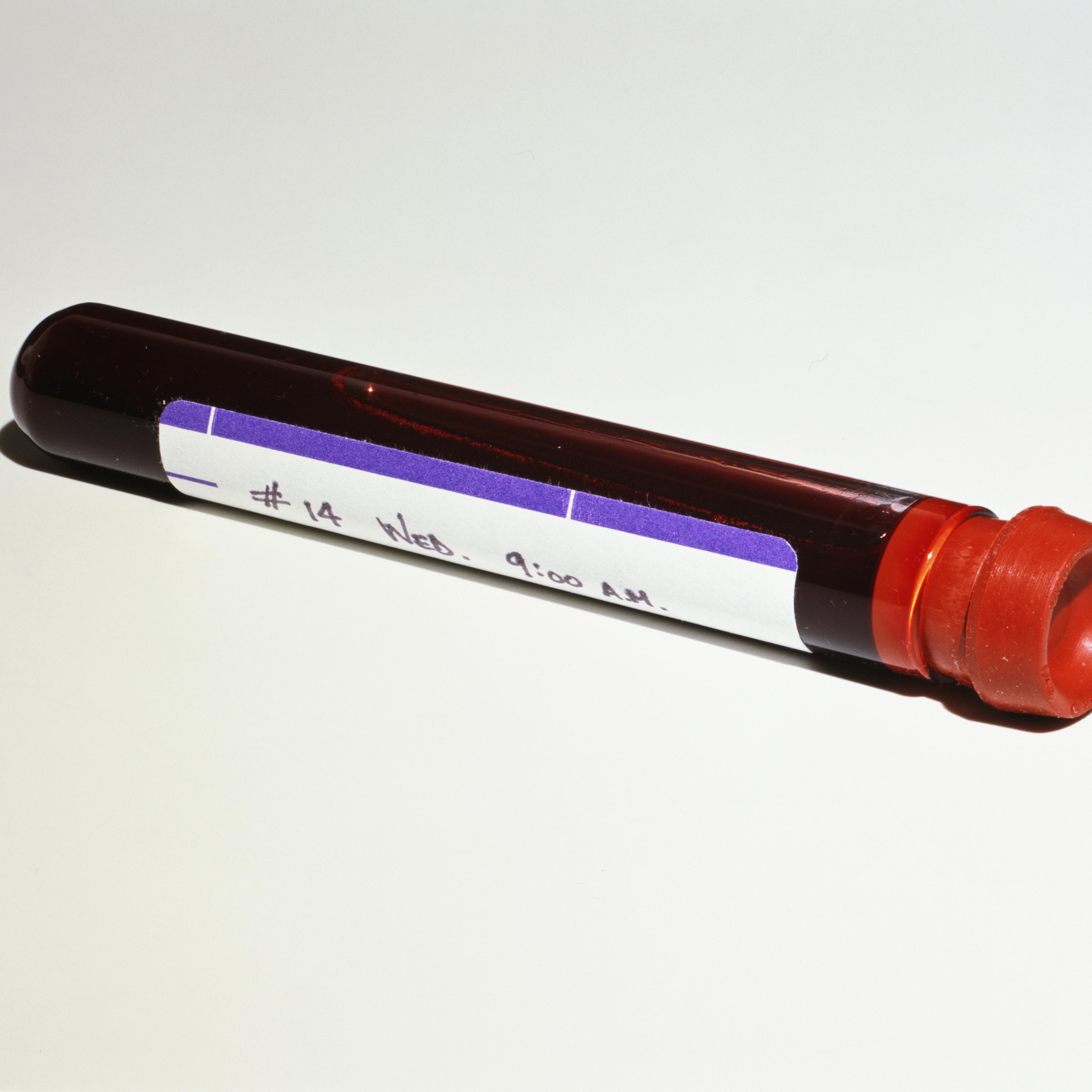 Blood sample in vial, against white background, close-up