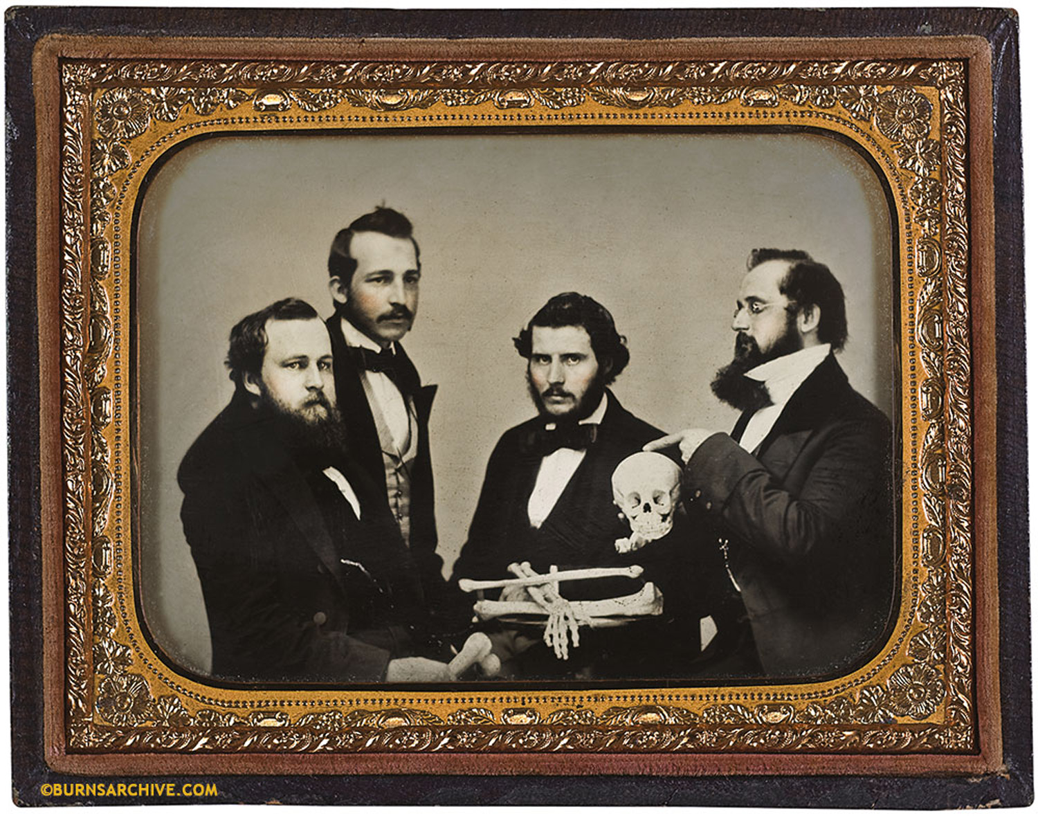 Studying Skull Anatomy Albany, NY 1857 