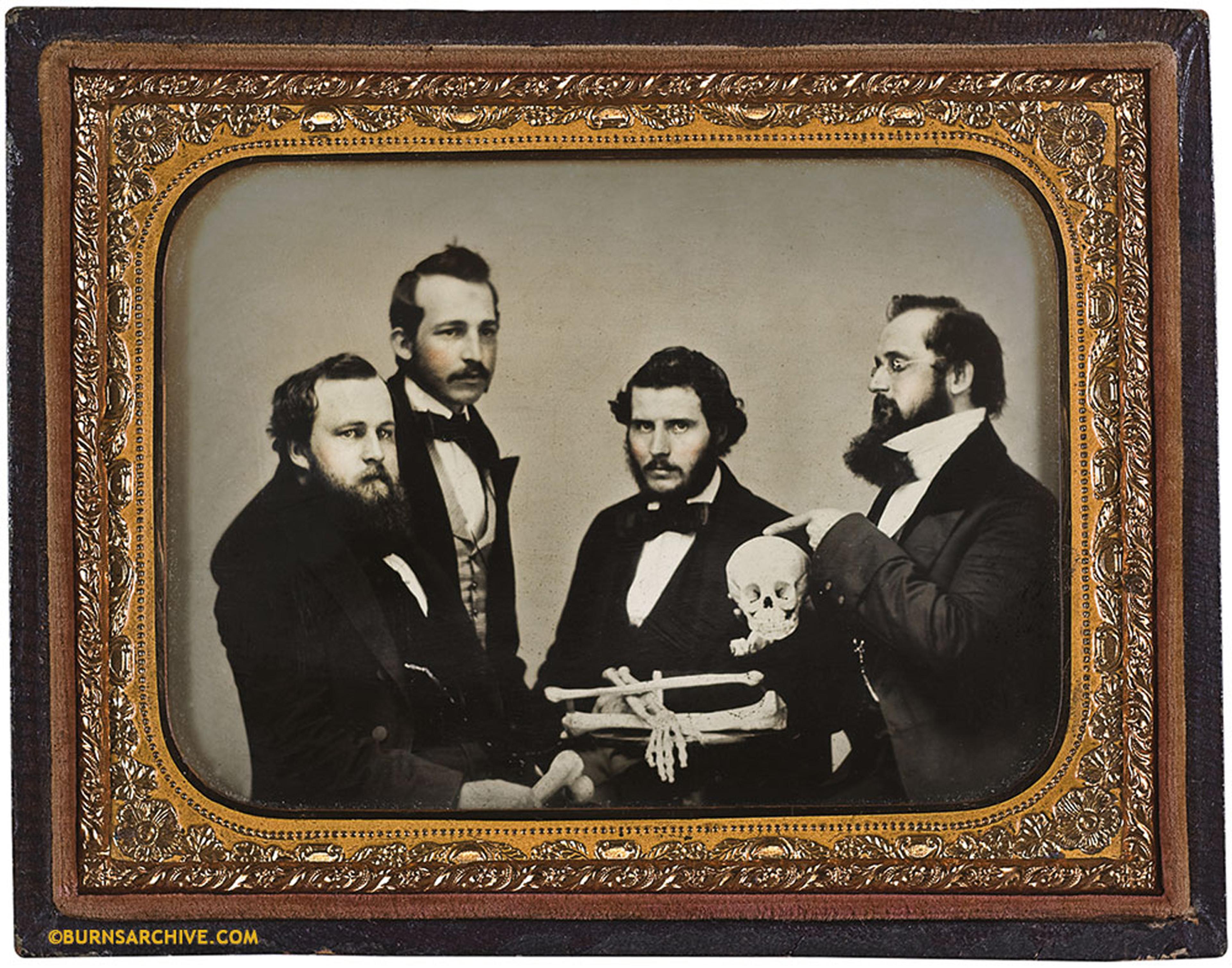 Studying Skull Anatomy Albany, NY 1857