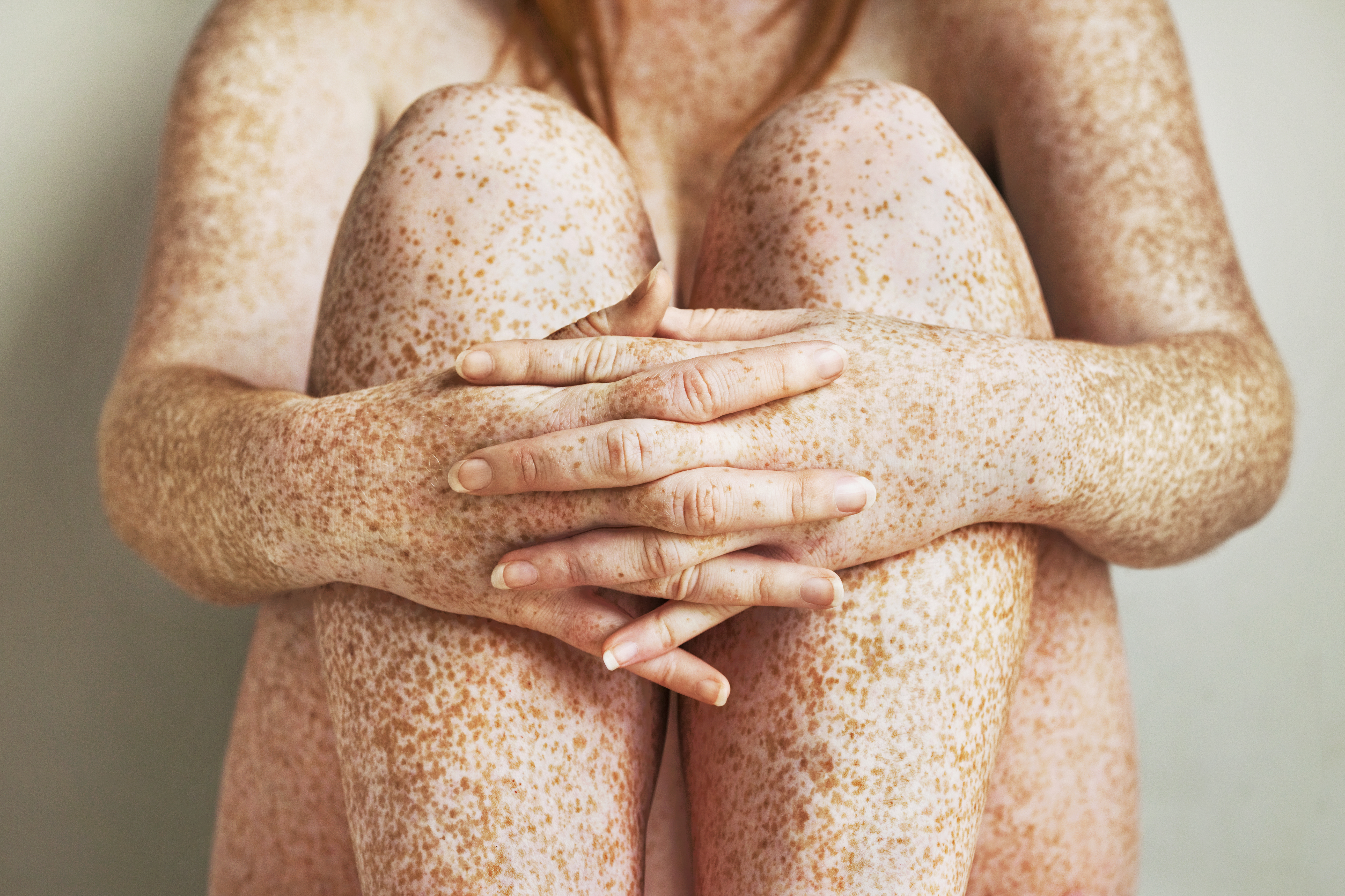 Freckled girls hands, arms and legs, close up TIME health stock