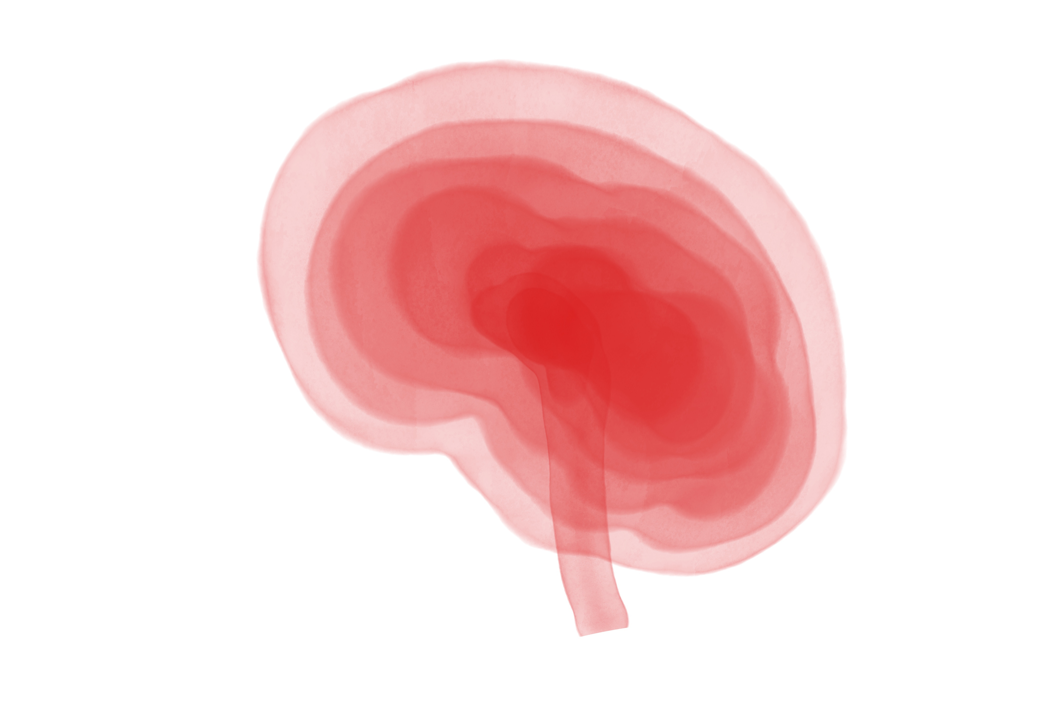 Cognitive Rehabilitation May Help Treat Long Covid, Study Says Cognitive Rehabilitation May Help Treat Long Covid, Study Says