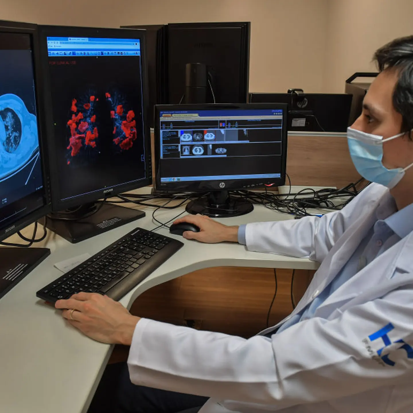 BRAZIL-HEALTH-VIRUS-DIAGNOSIS-ARTIFICIAL INTELLIGENCE