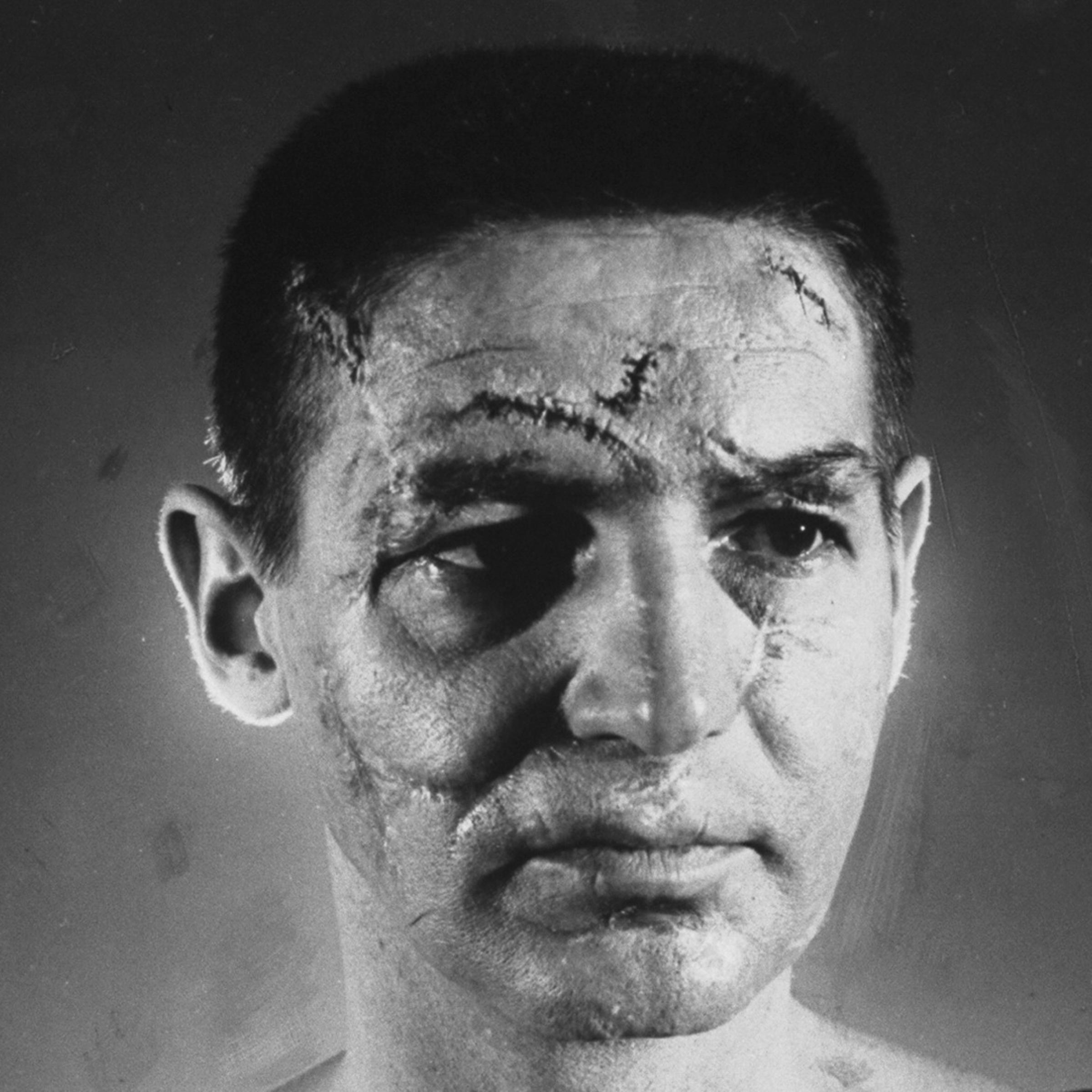 Goalie Terry Sawchuk sports fake scars and wounds applied by a make-up artist to simulate injuries accumulated in 16 years of professional hockey, 1966.