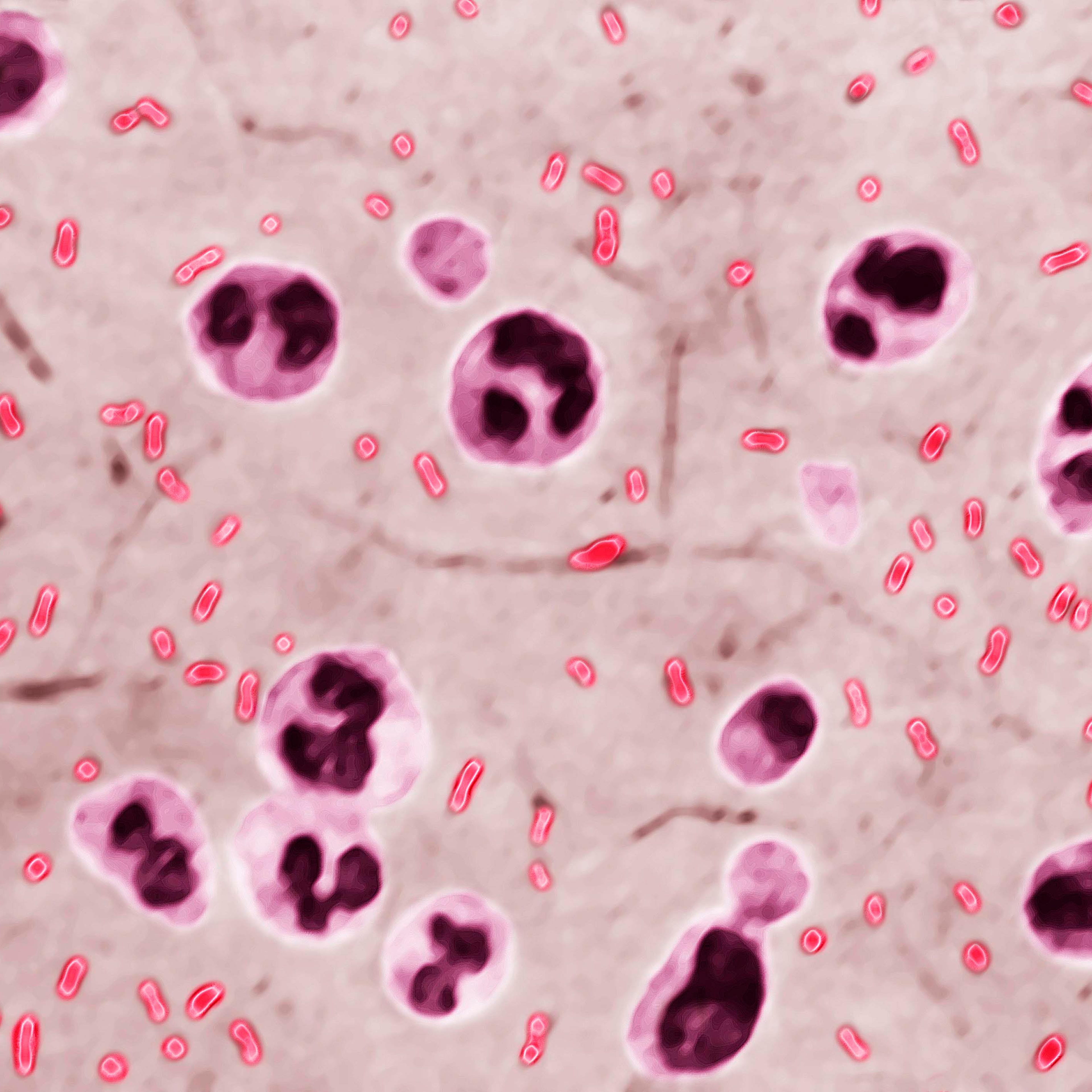 Yersinia Pestis