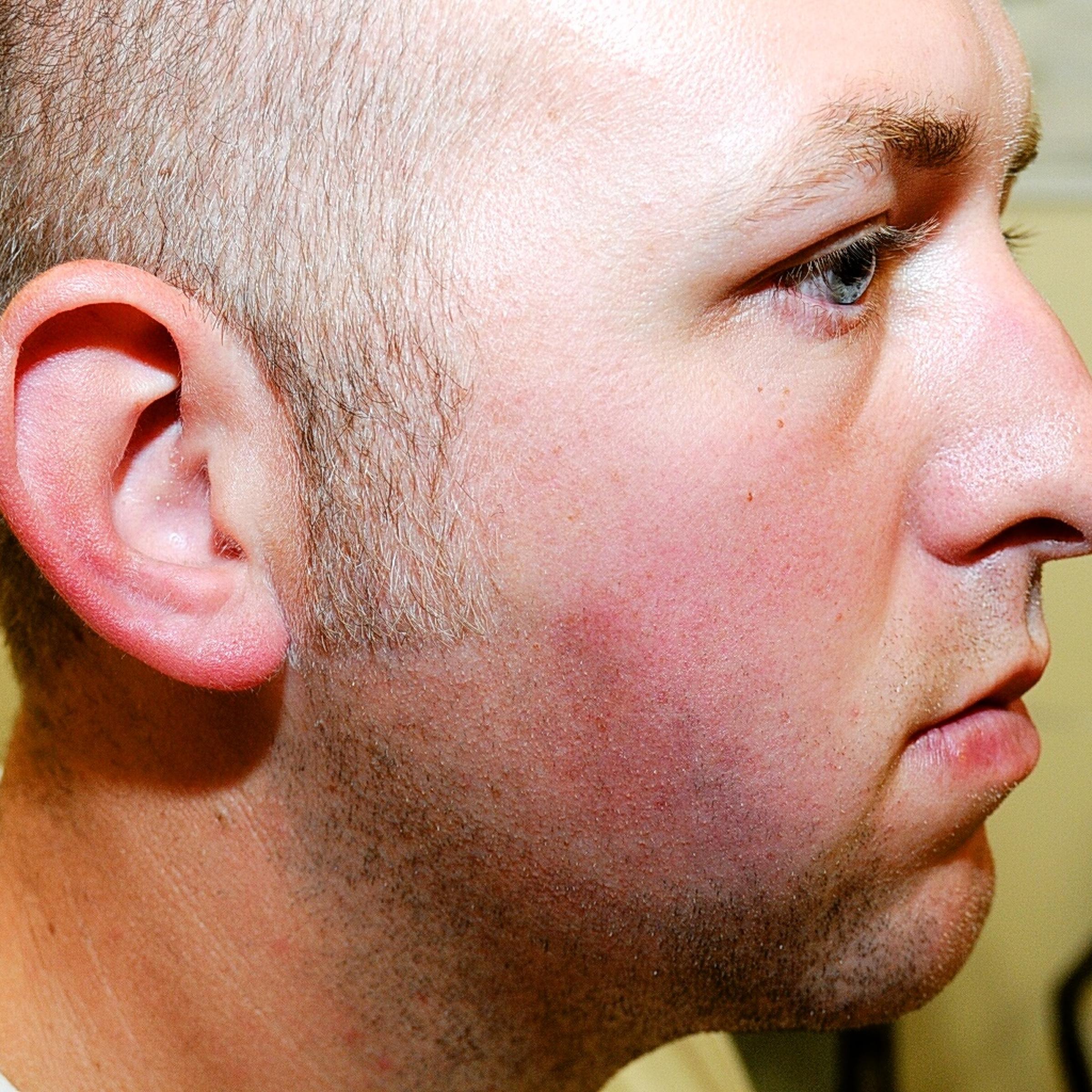 Ferguson Police Officer Darren Wilson