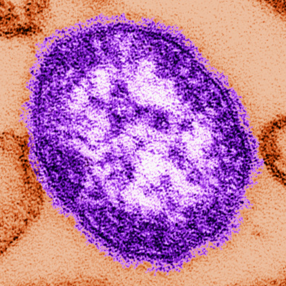 Measles-Virion