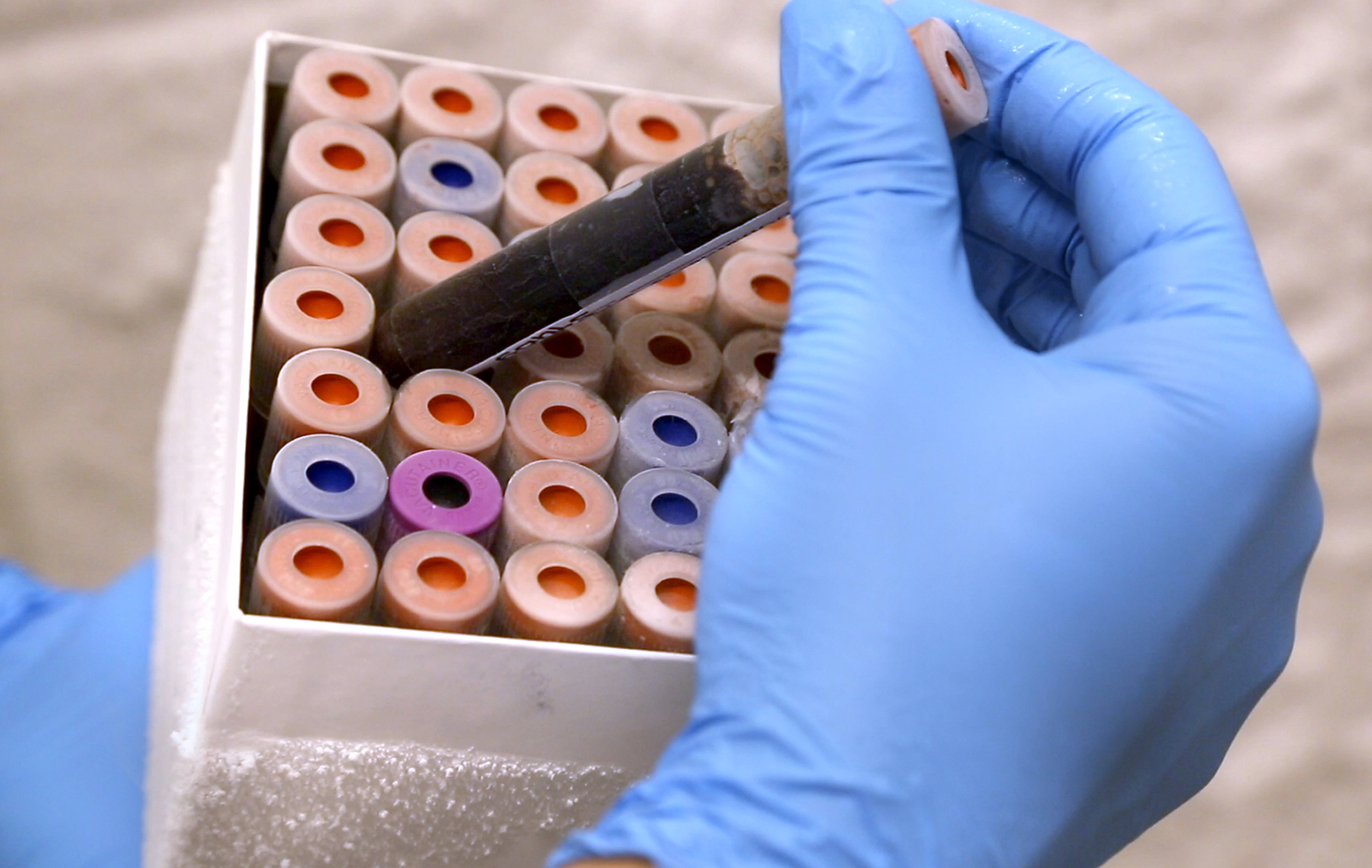 In this image provided by Duke University, lab research analyst Marshall Nichols does research relating to a new blood test on Tuesday, Sept. 17, 2013, in Durham, N.C.
