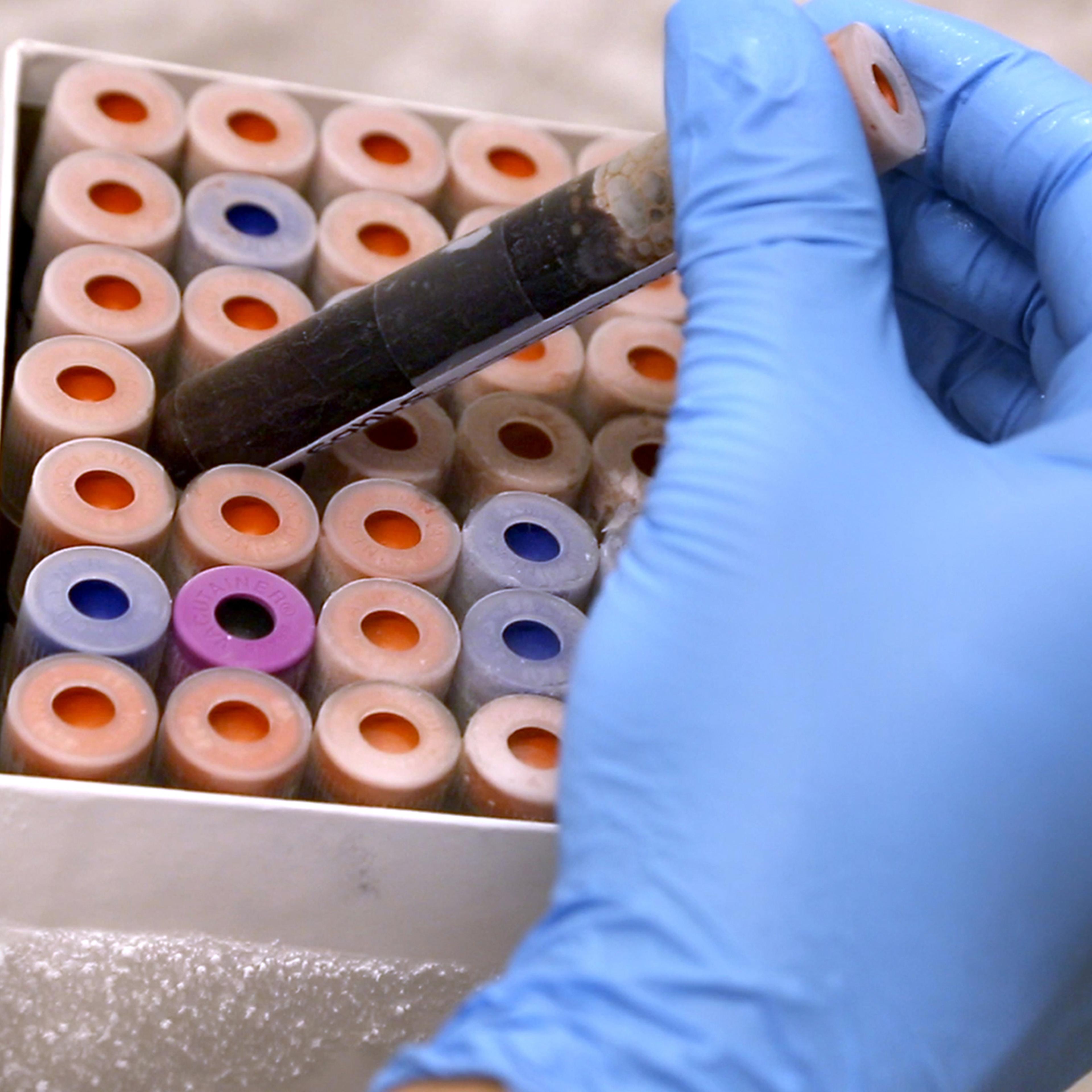 In this image provided by Duke University, lab research analyst Marshall Nichols does research relating to a new blood test on Tuesday, Sept. 17, 2013, in Durham, N.C.
