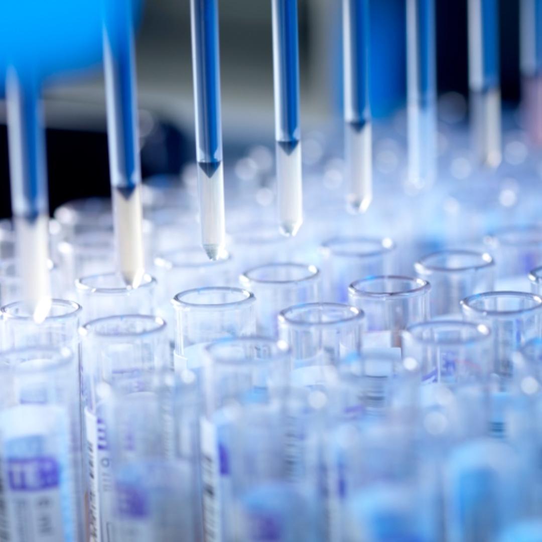 Blood testing for HIV