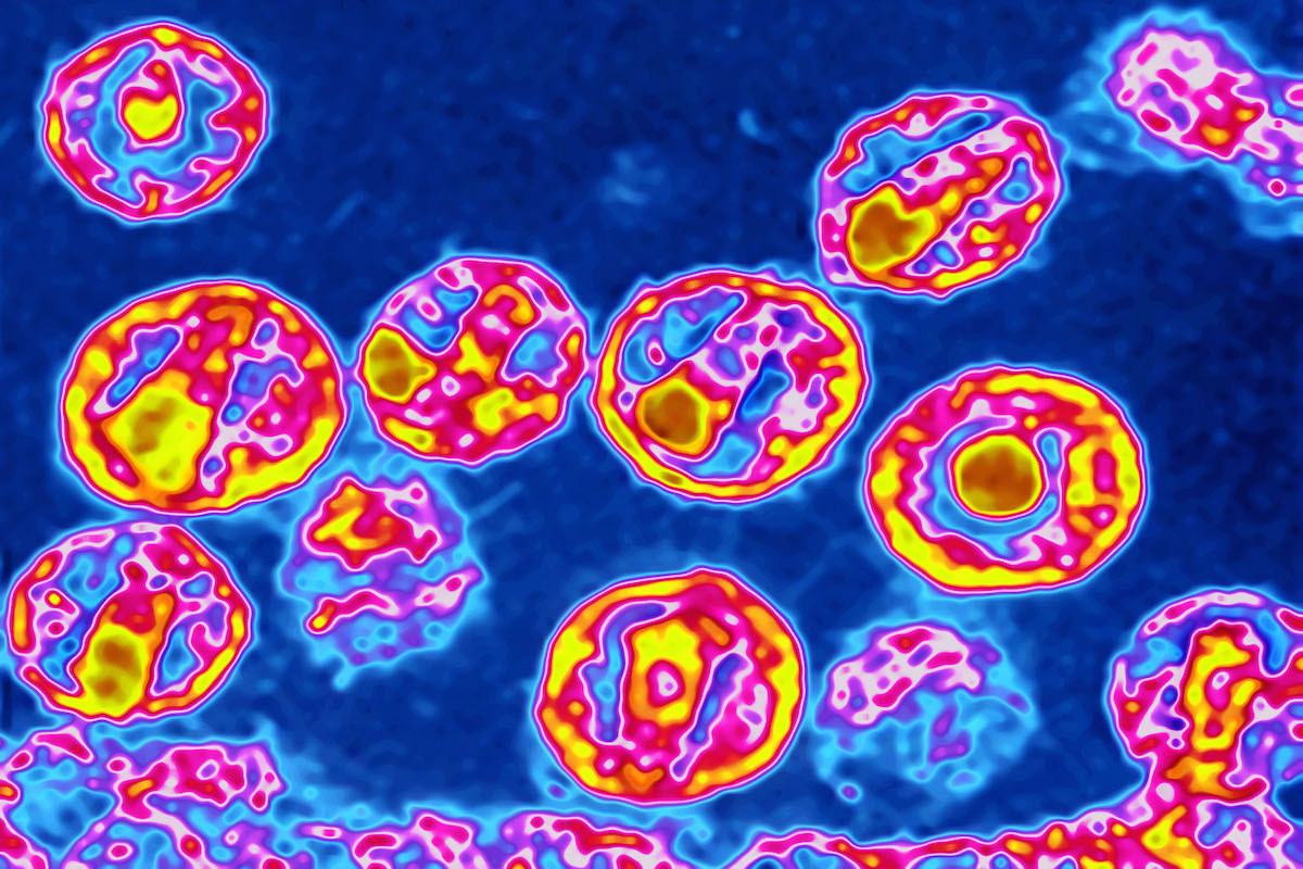Aids Virus, Tem
