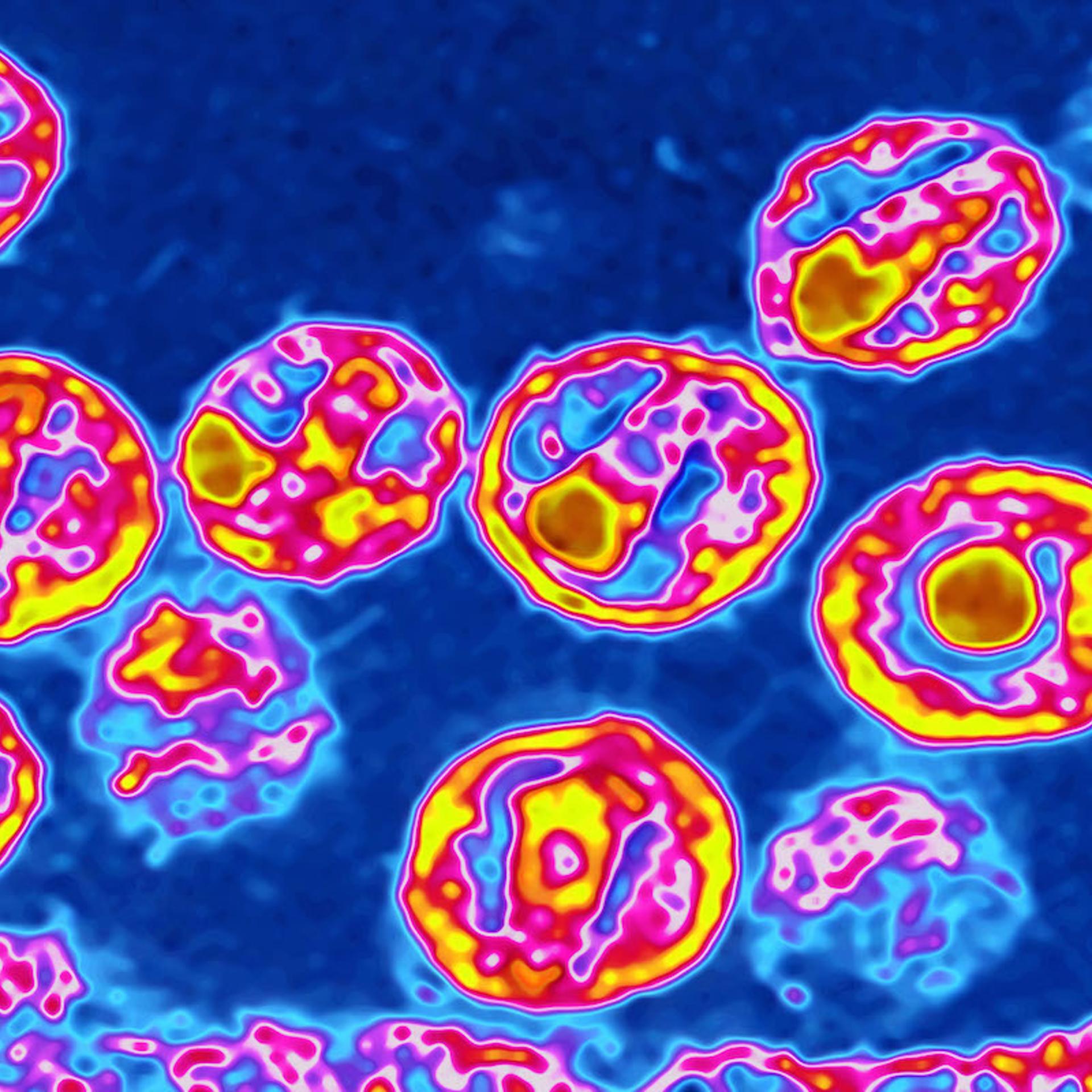Aids Virus, Tem