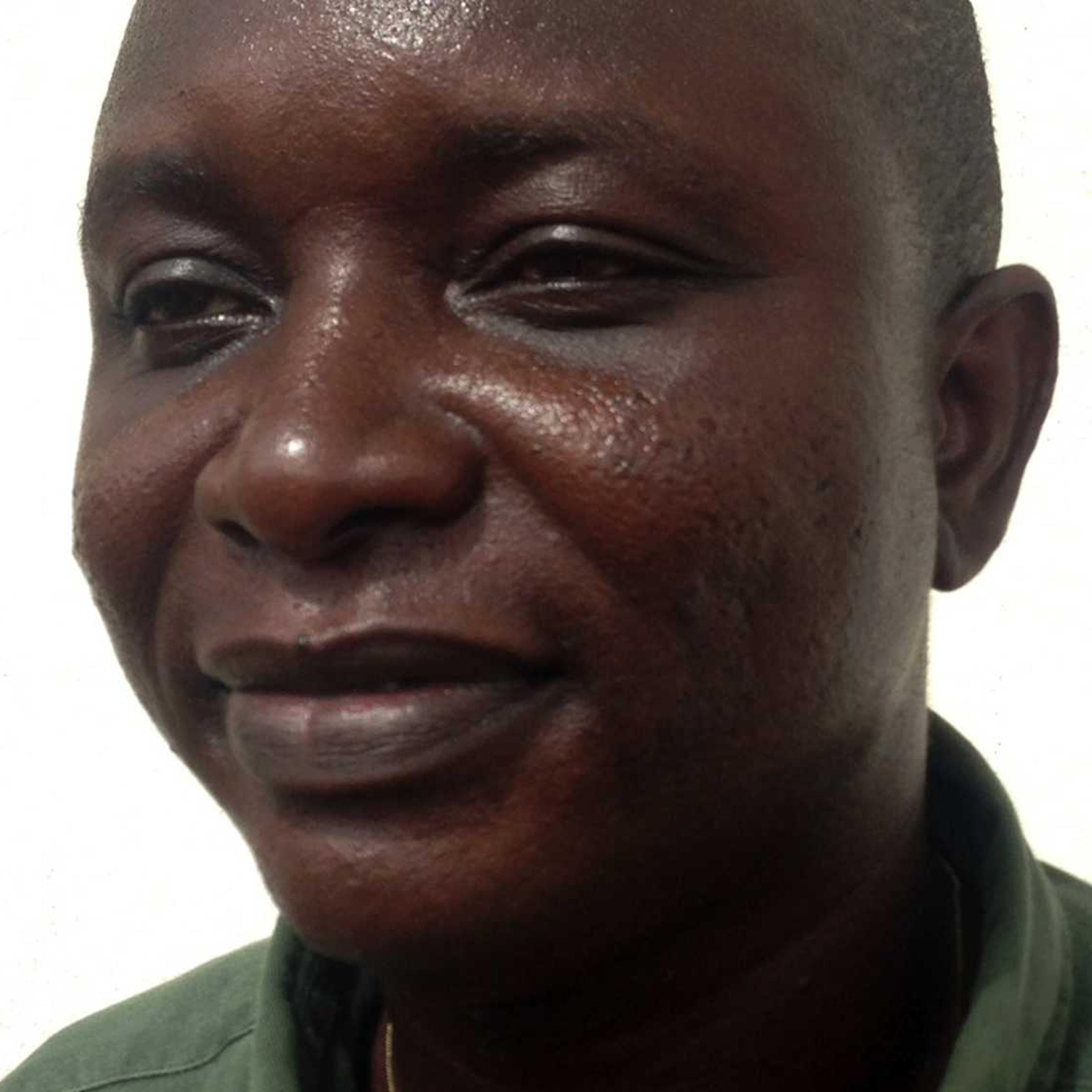 Sheikh Umar Khan, head doctor fighting the deadly tropical virus Ebola in Sierra Leone, poses for a picture in Freetown on June 25, 2014