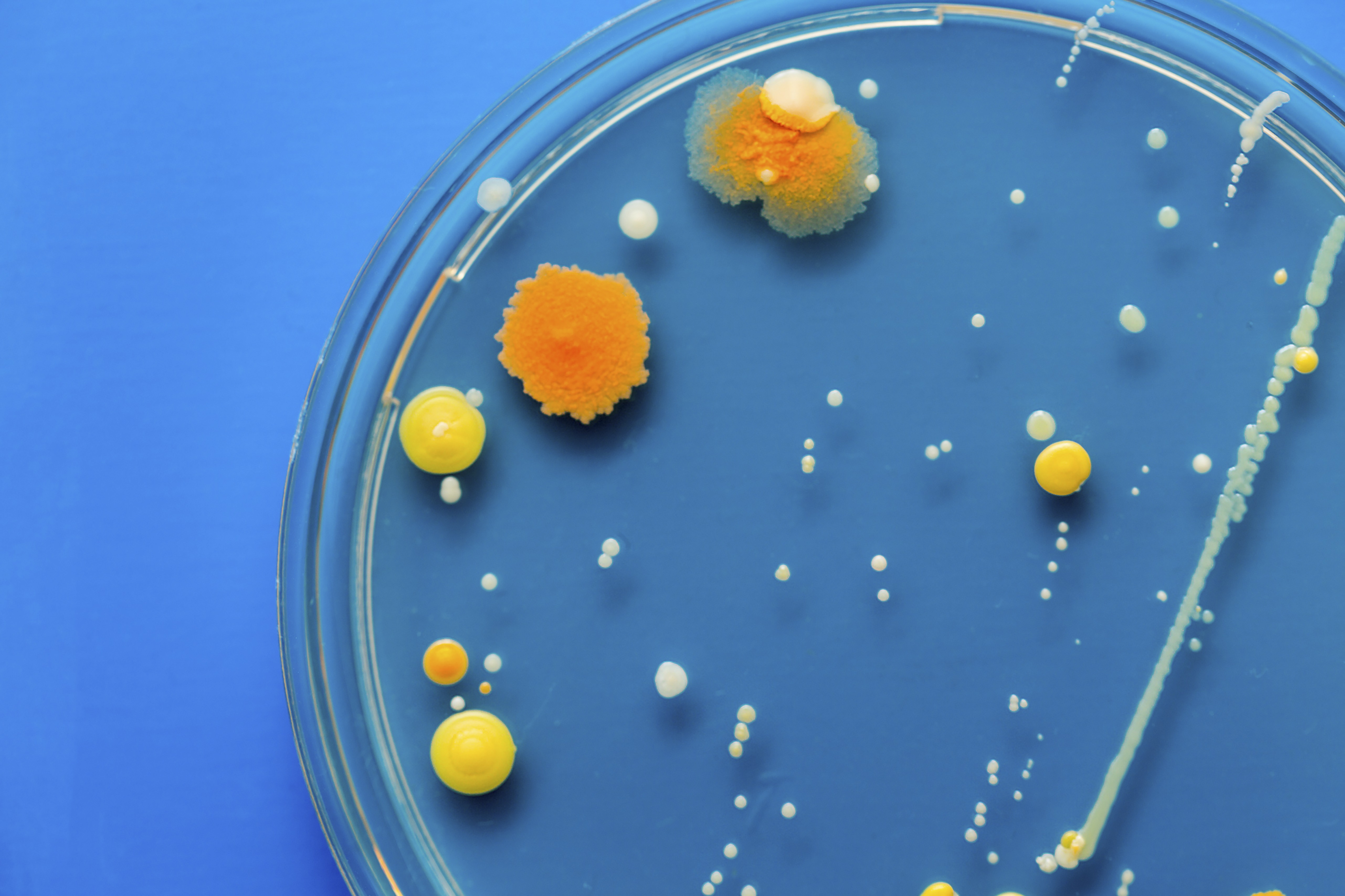 Bacteria in a petri dish