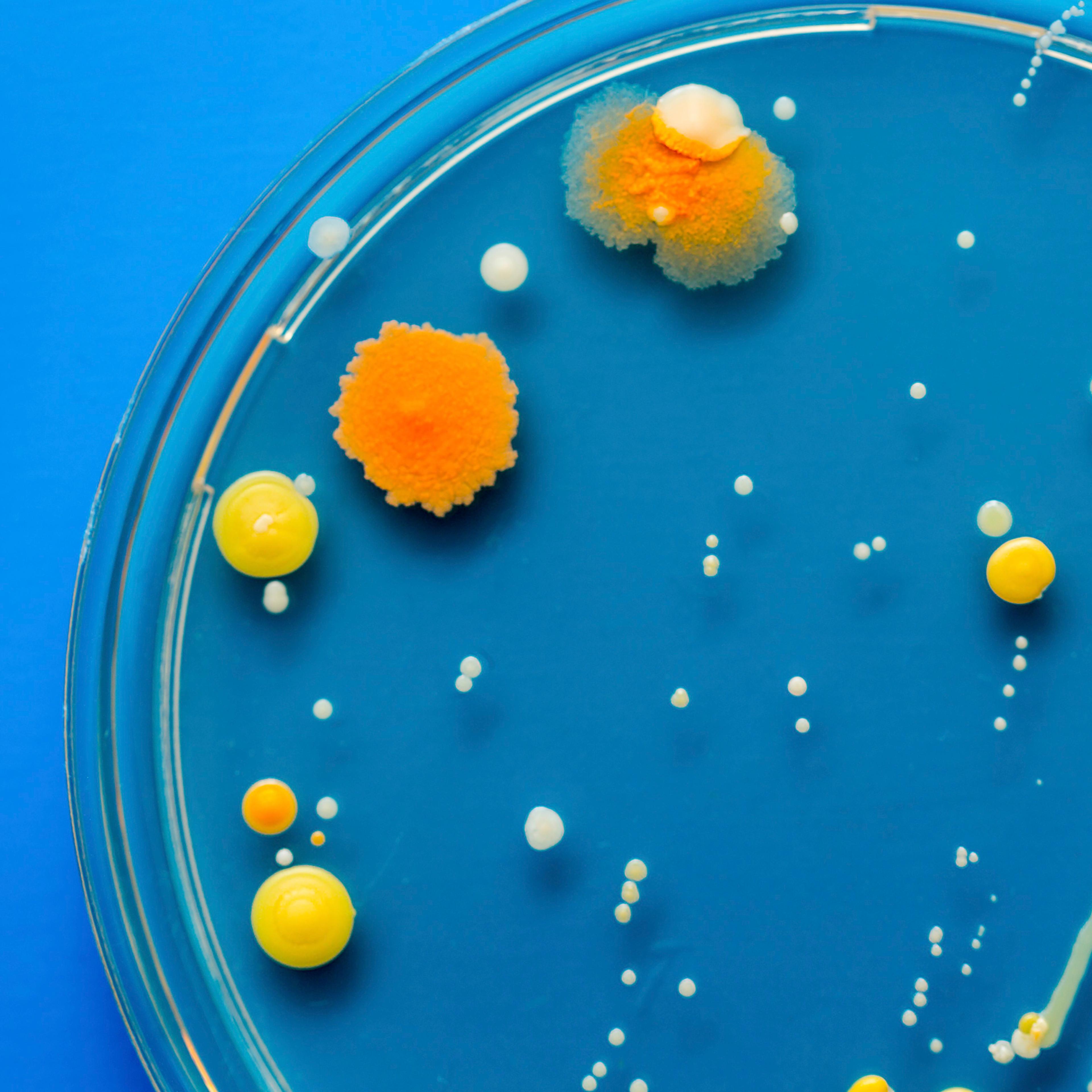 Bacteria in a petri dish