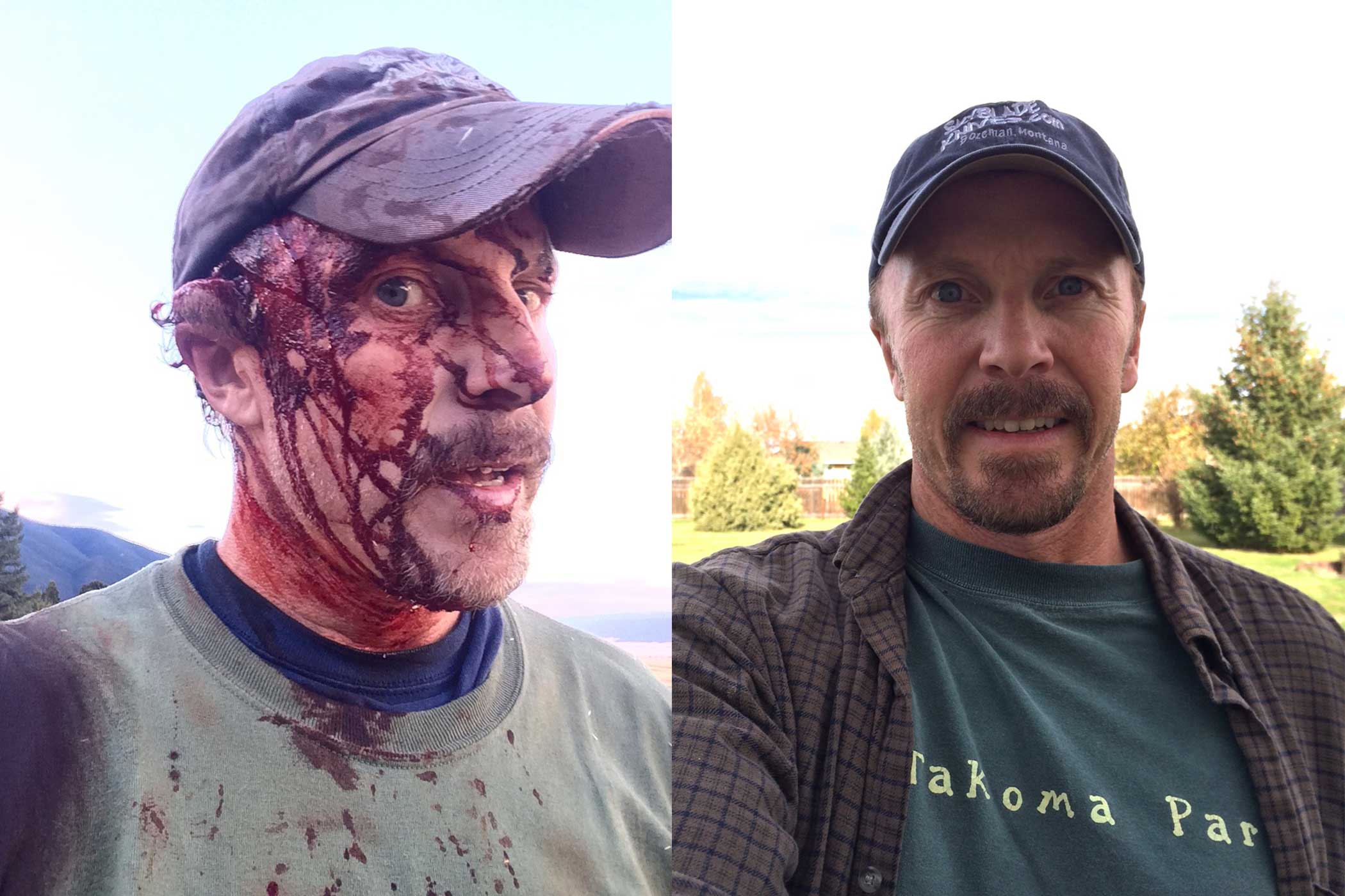 Todd Orr directly after the attack and again a few weeks afterward.