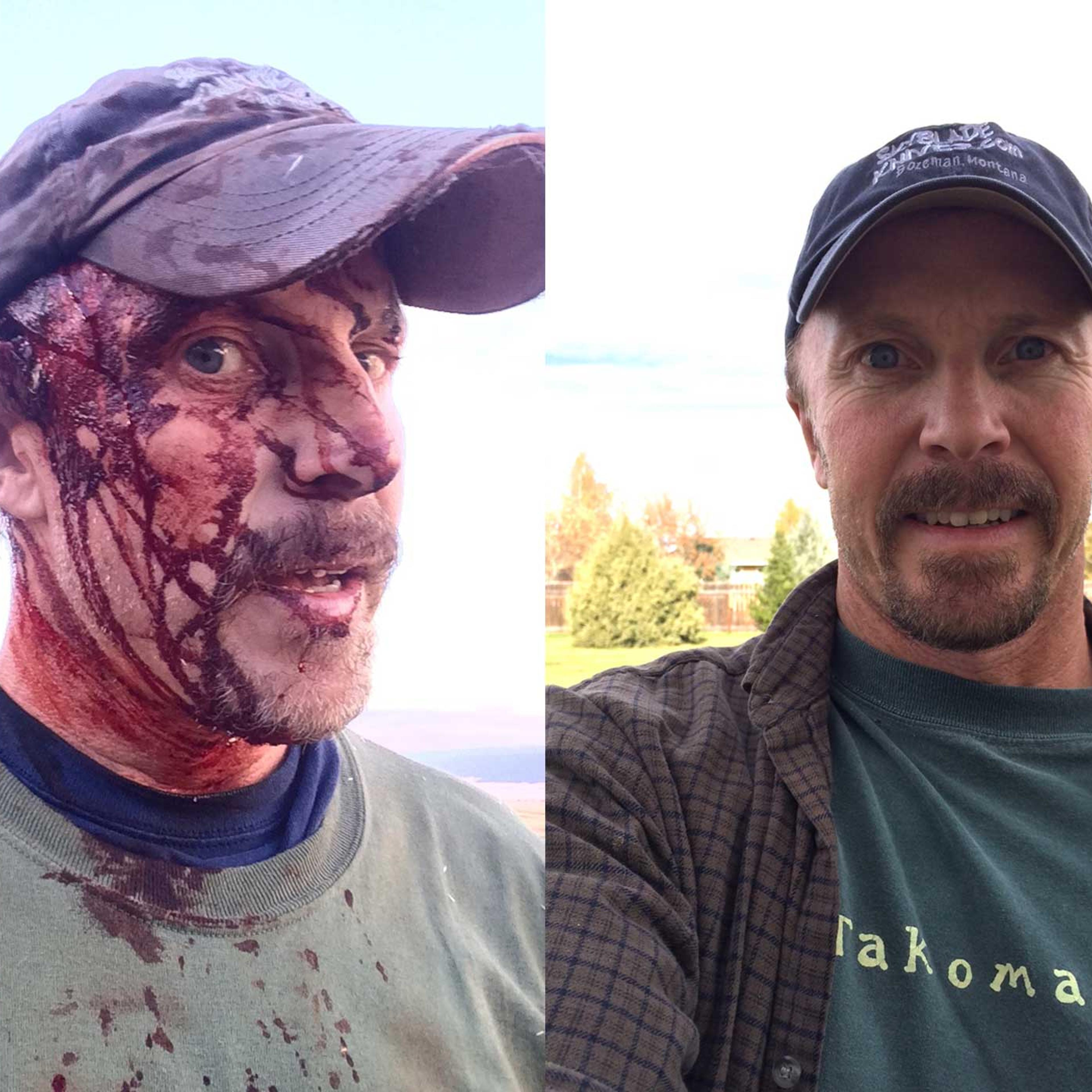 Todd Orr directly after the attack and again a few weeks afterward.
