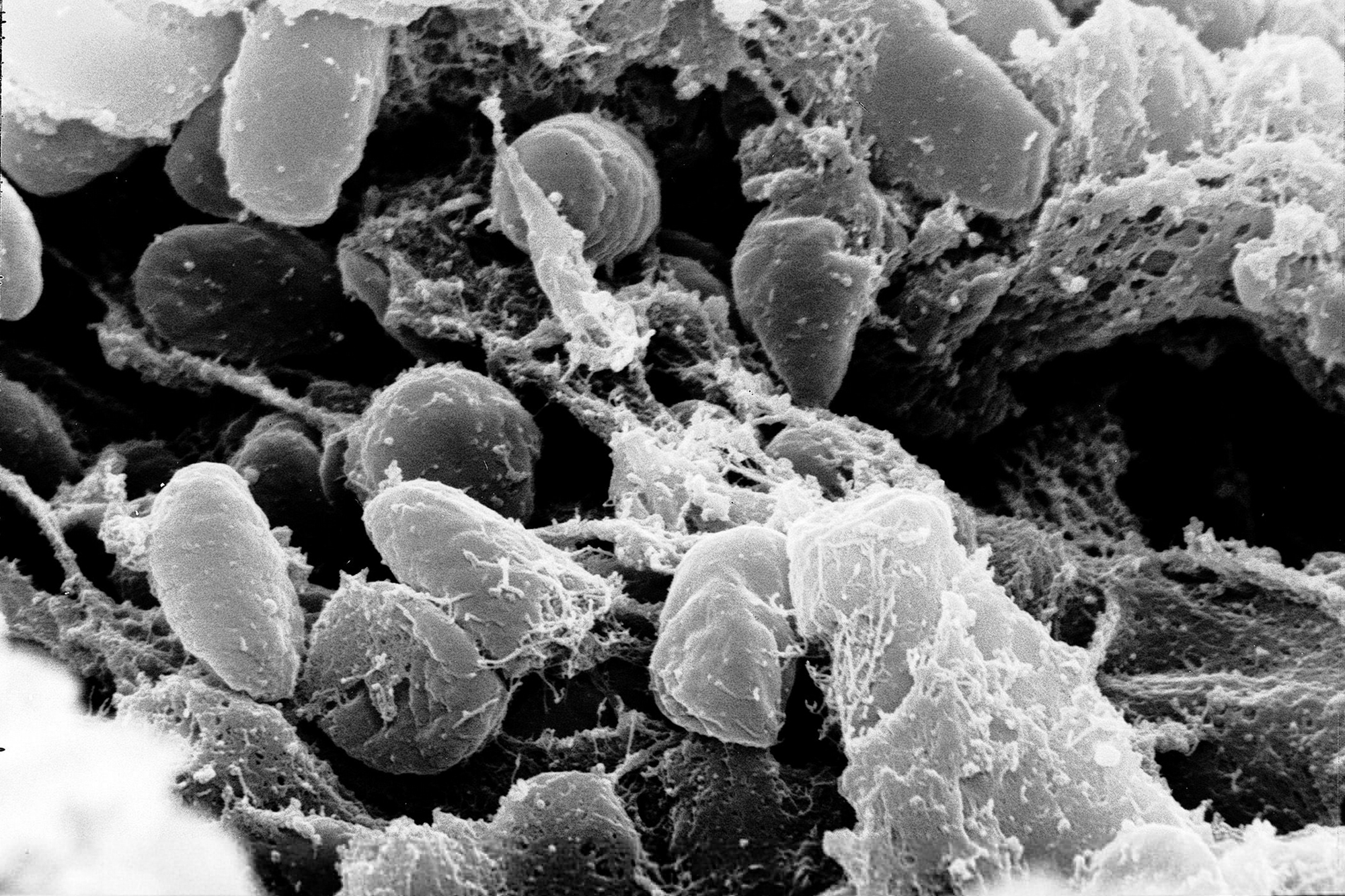 Yersinia Pestis SEM
